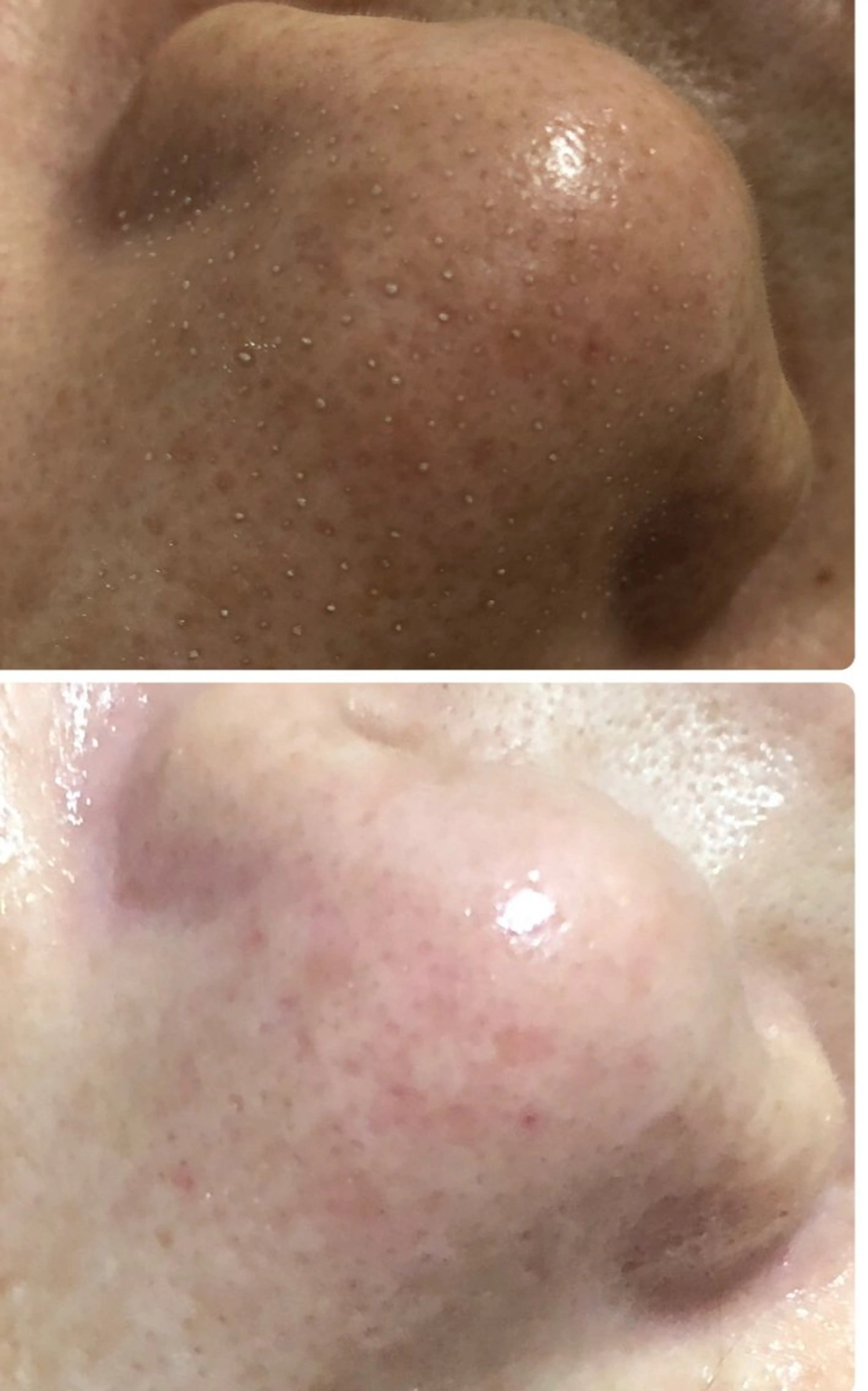 private salon  Dea_maris シュガーリング＆パーソナルボディケア所属・シミ改善・韓国肌管理 ボディメイク痩身のその他イメージ