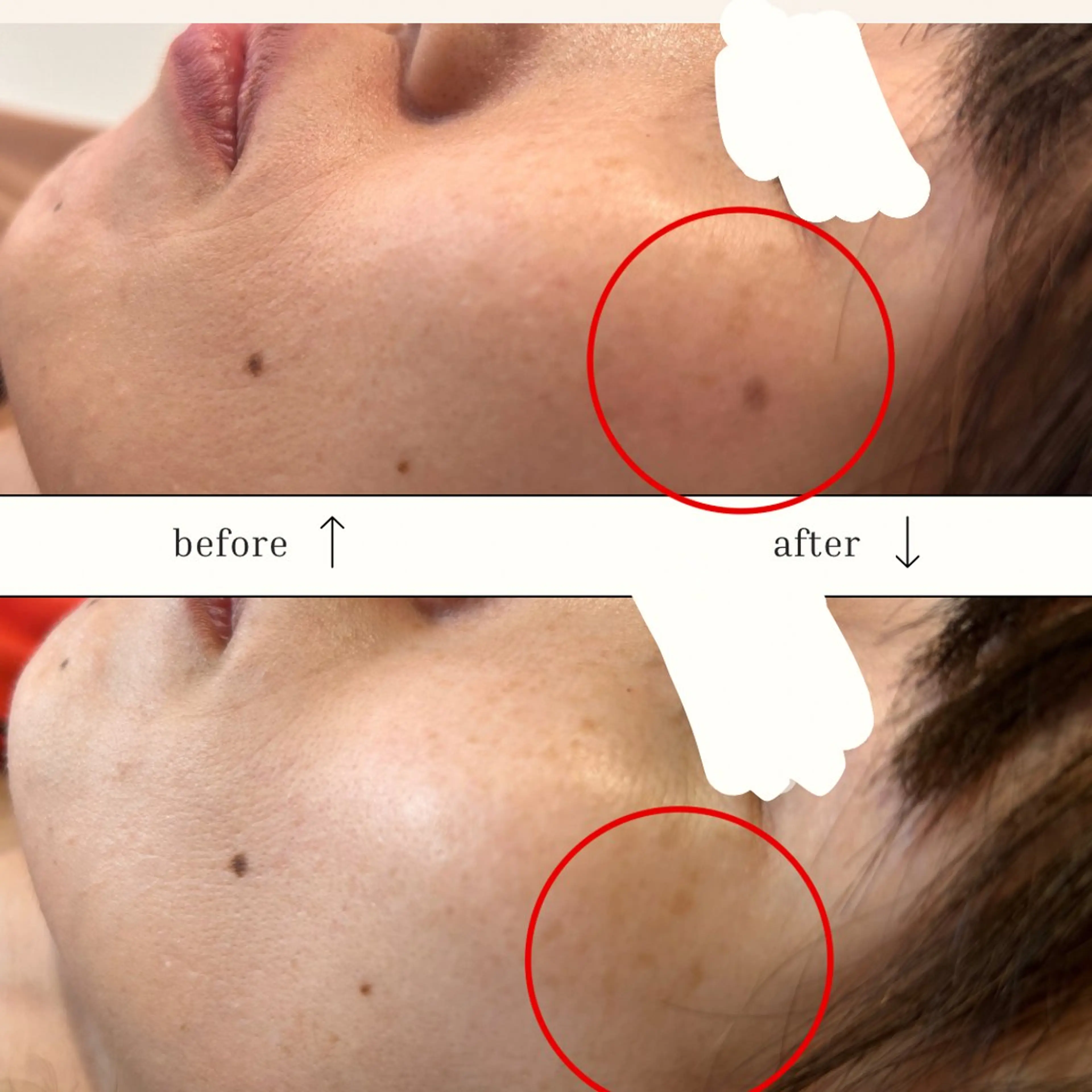 エステ N.style所属・Ｎ. styleのネイルデザイン