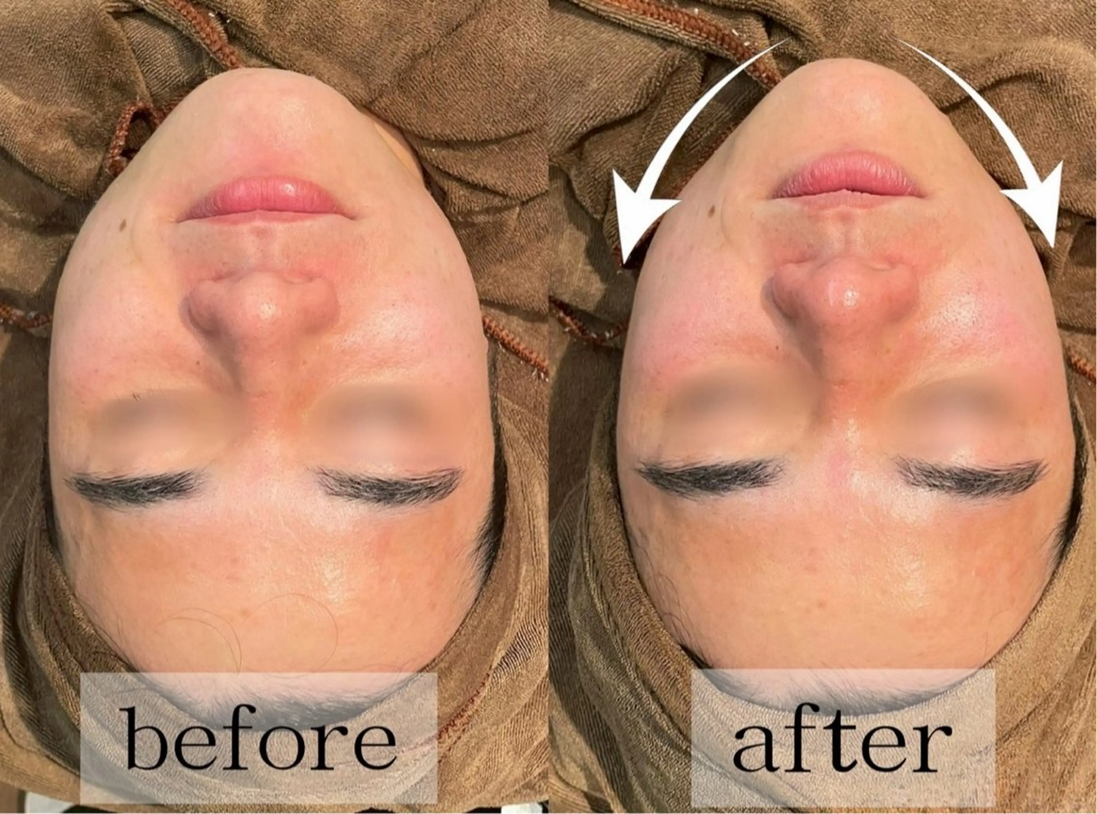 毛穴・肌質ケア専門 グランビューティーのエステ・リラクイメージ