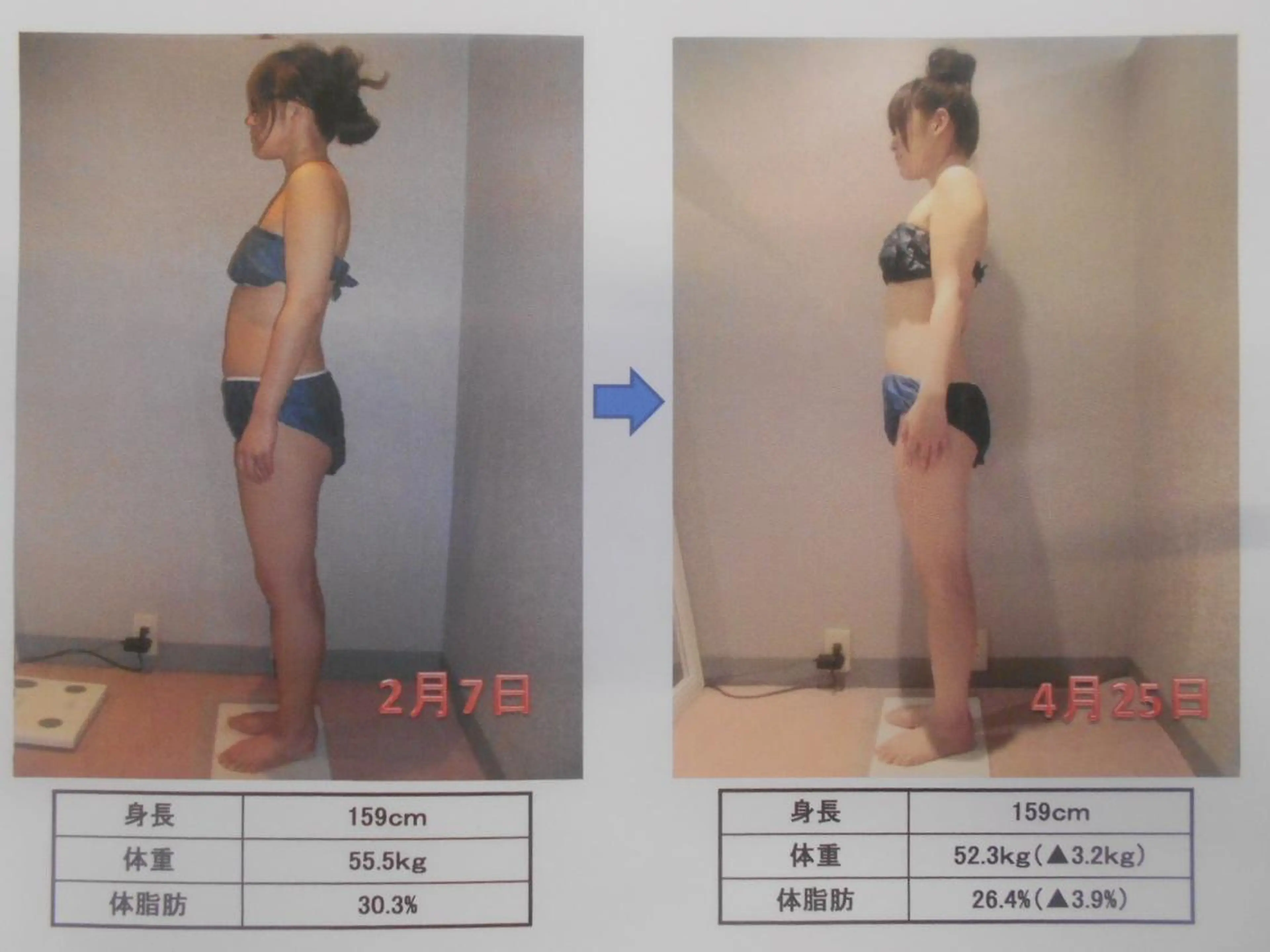 肩こり/首こり/ 小出愛のその他イメージ