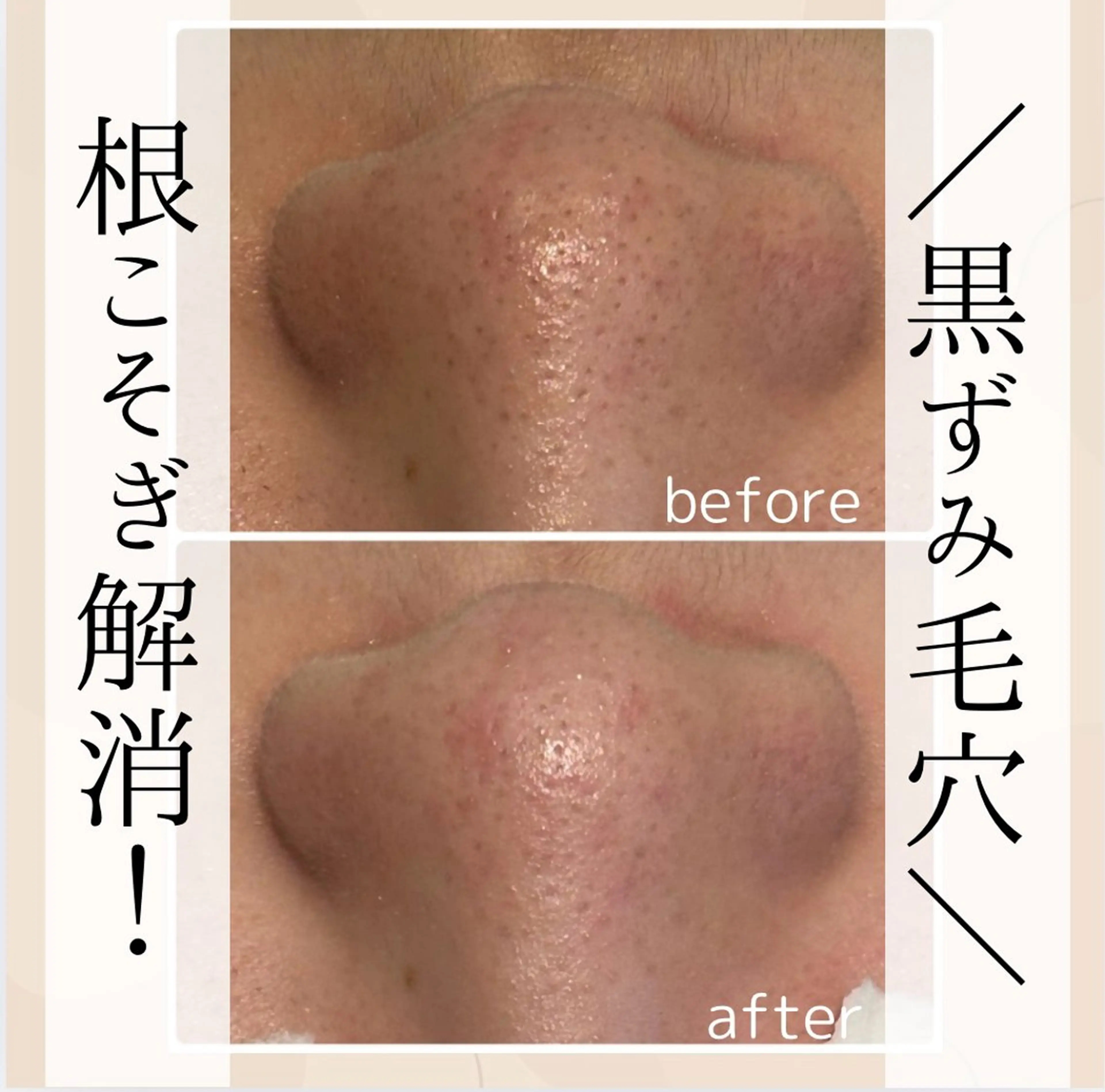 エステ 小顔・毛穴・たるみ ネイル　似内真樹のエステ・リラクイメージ