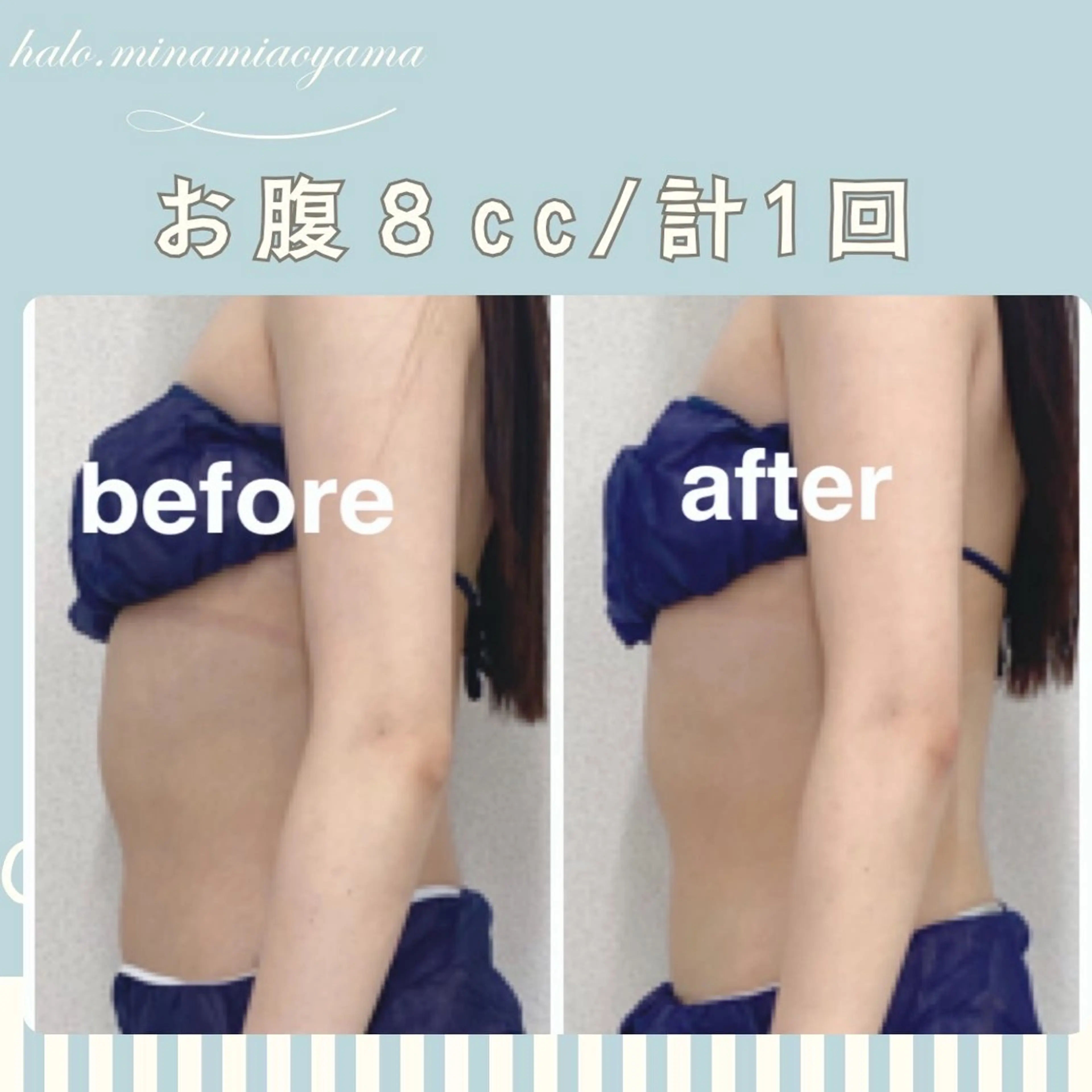 エステ 小顔痩身HALO 二宮早織のエステ・リラクイメージ