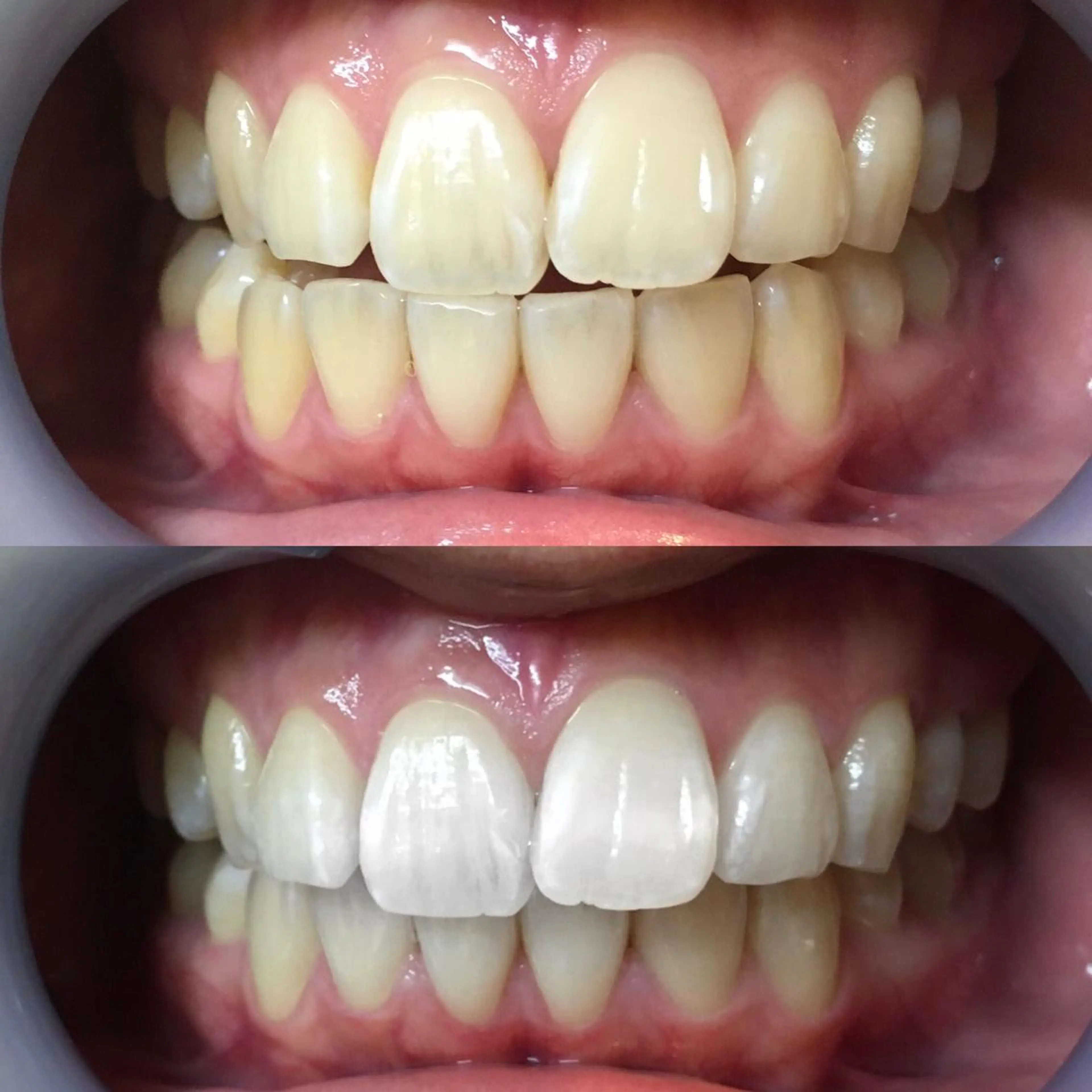 エステ リラク LBSホワイトニング 新宿店💝店長熊倉のその他イメージ