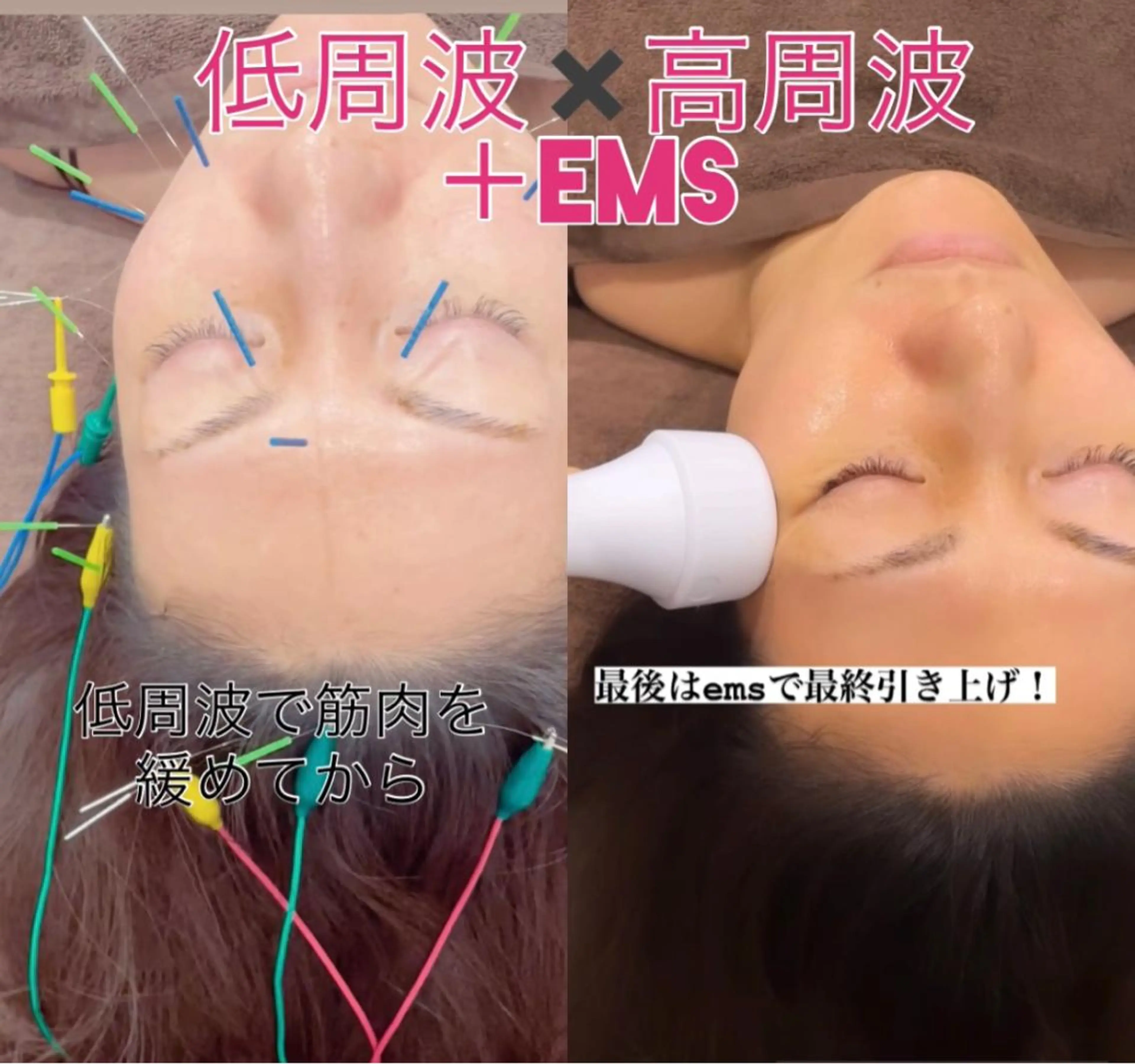 美容鍼灸サロン mahoroba院長のエステ・リラクイメージ