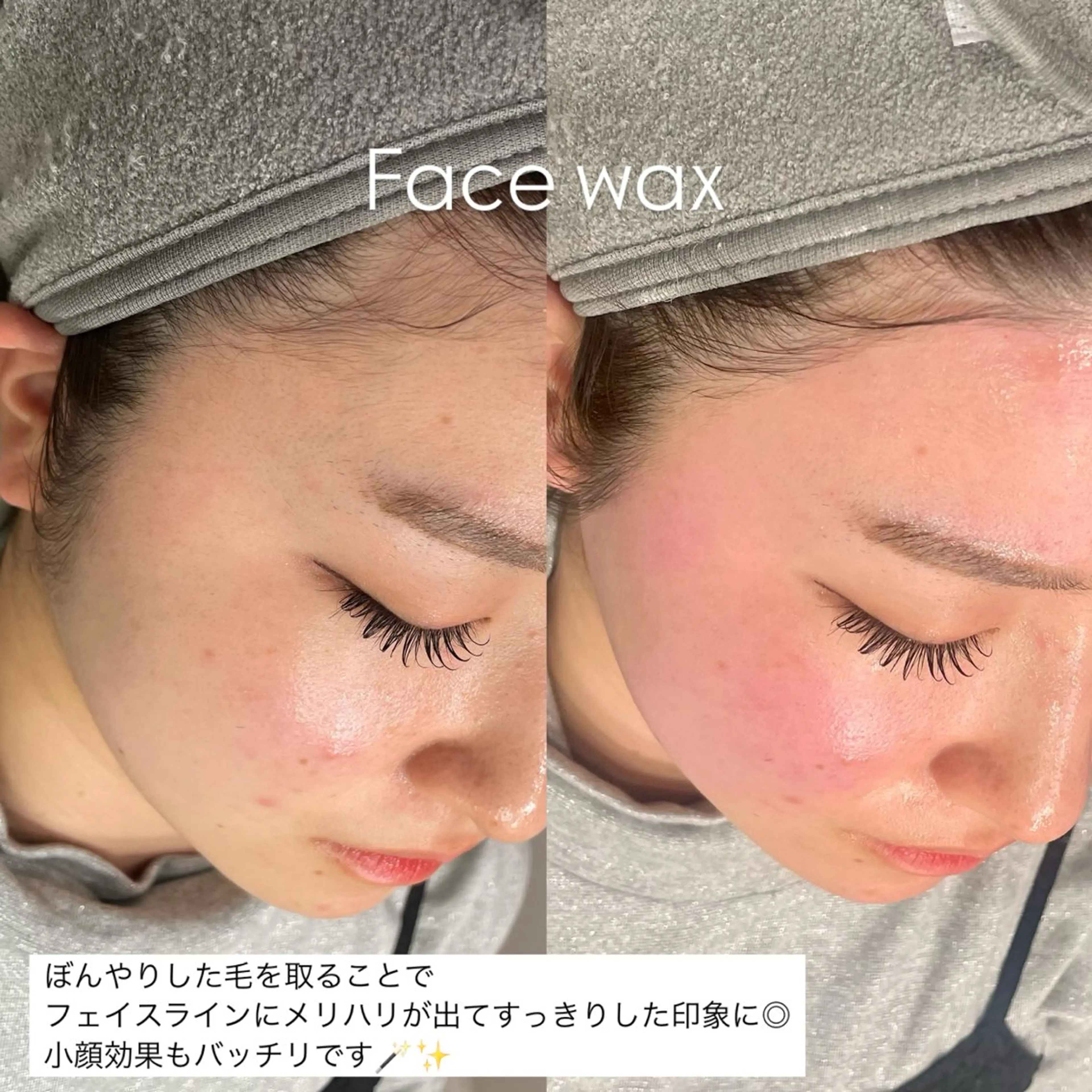 脱毛 suu ｜harukaのマツエク・マツパデザイン