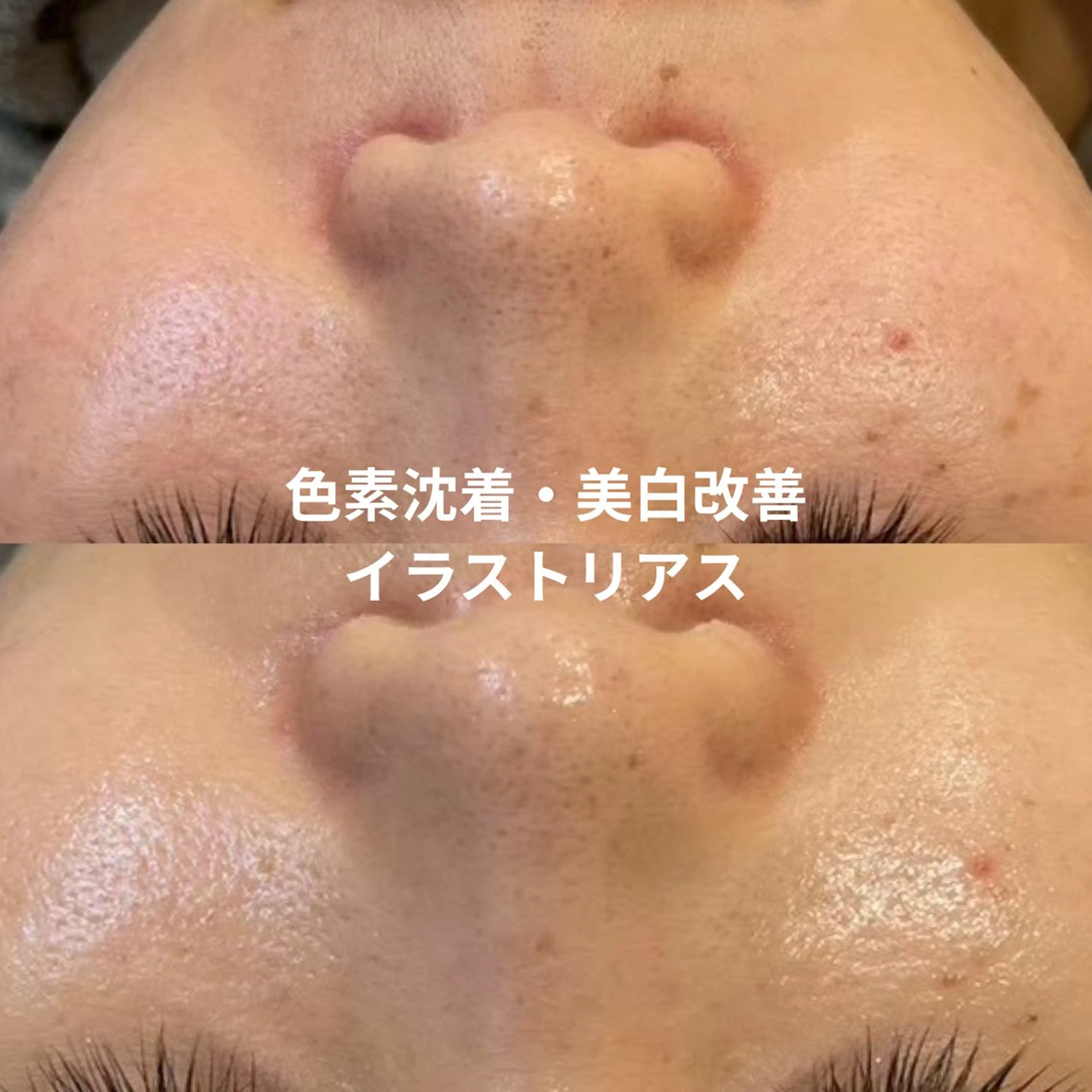 LEPUS【レプス】 sekiのエステ・リラクイメージ