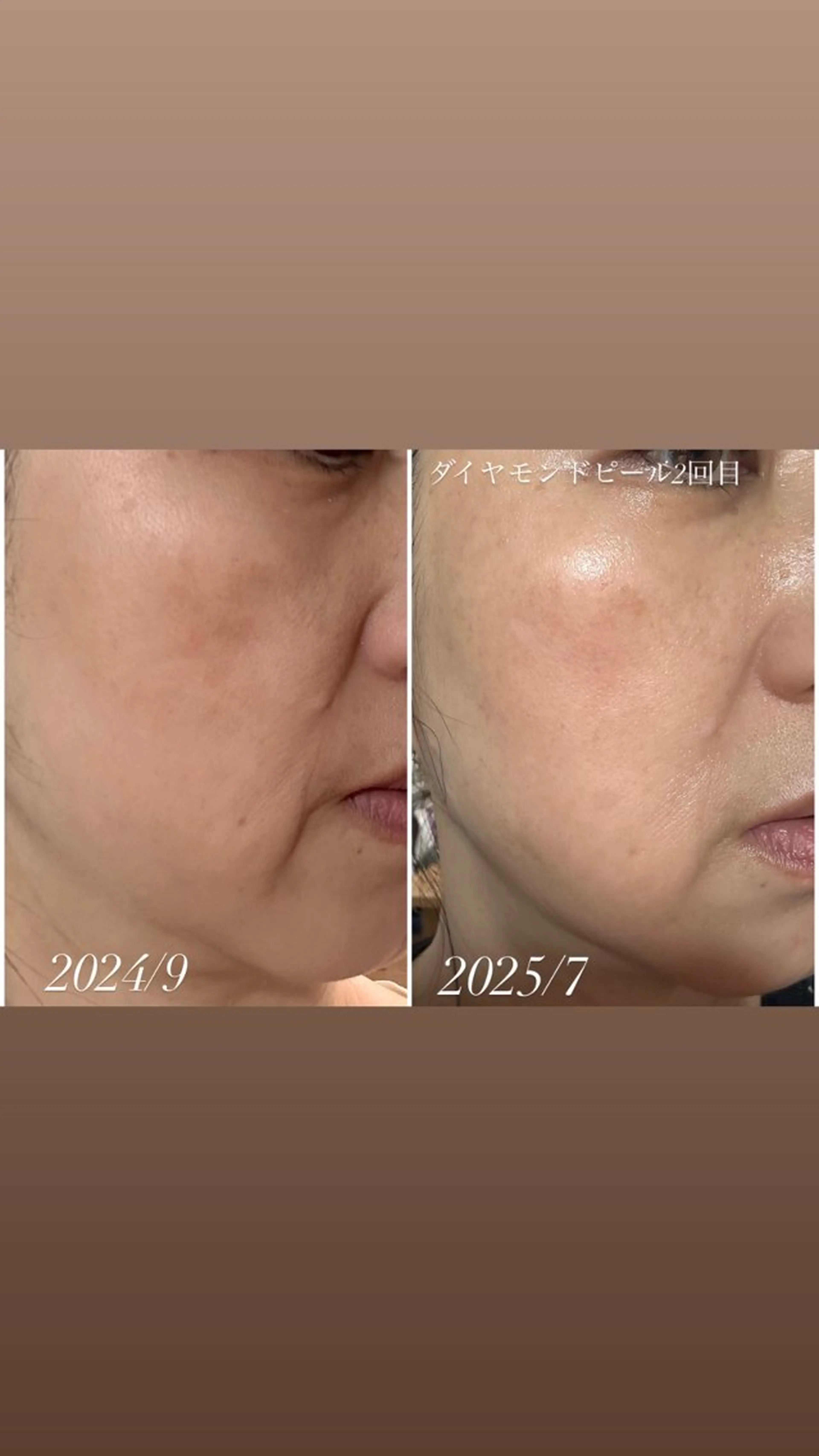 ヘッドスパ専門/豊中 apricotのエステ・リラクイメージ