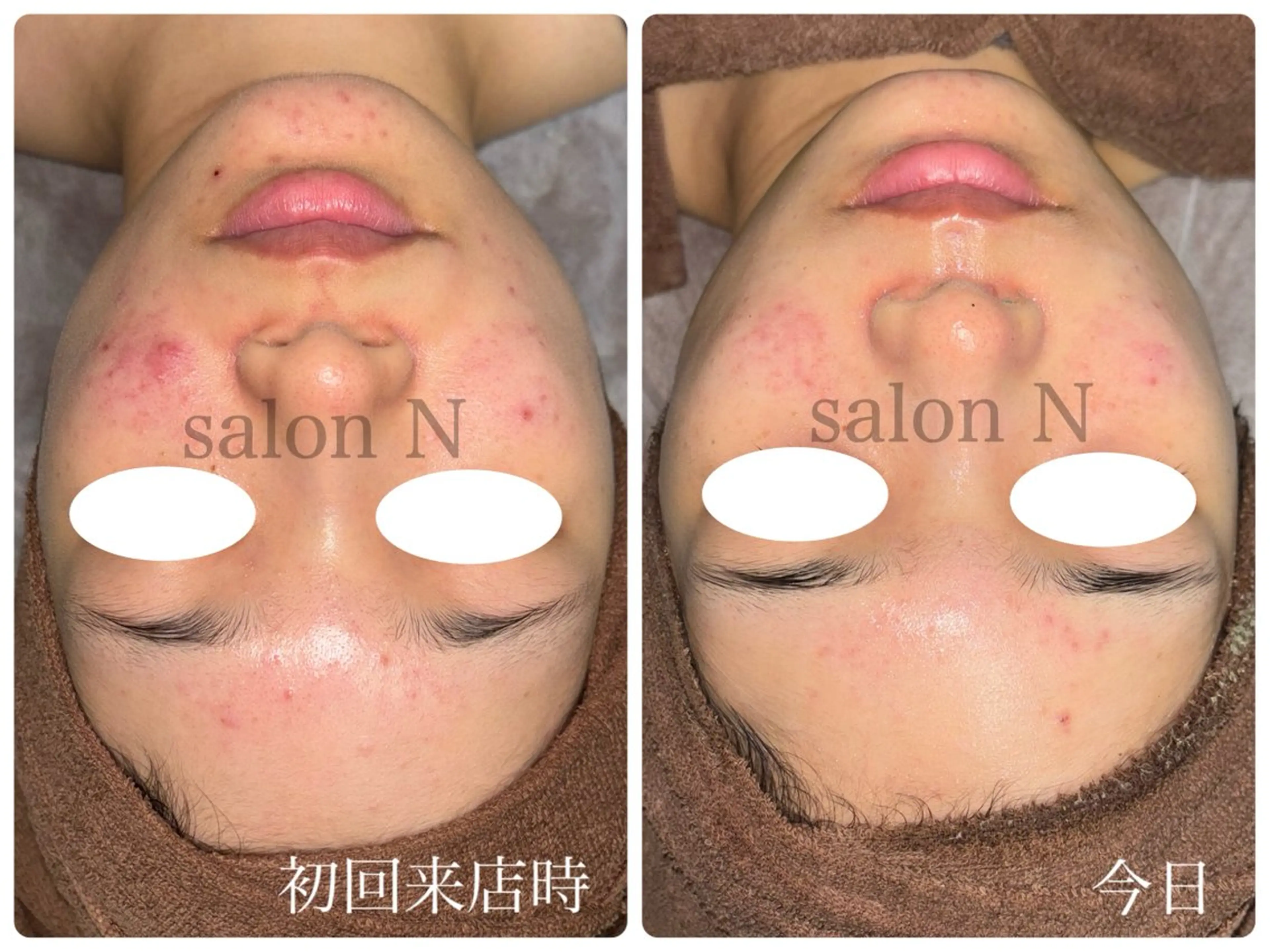 エステ salonＮ所属・星野 マリアのエステ・リラクイメージ