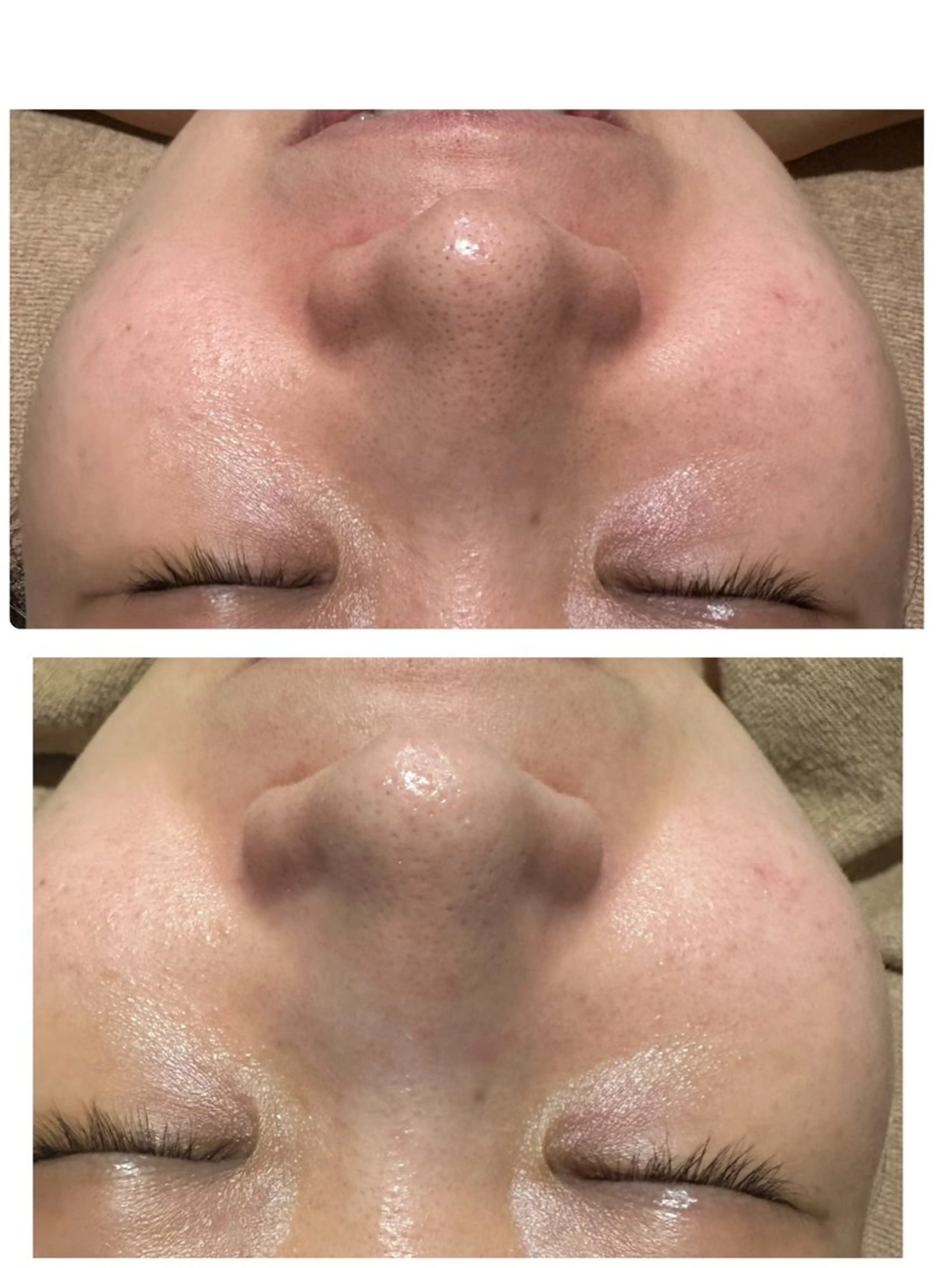 エステ 堀尾 あけみのエステ・リラクイメージ