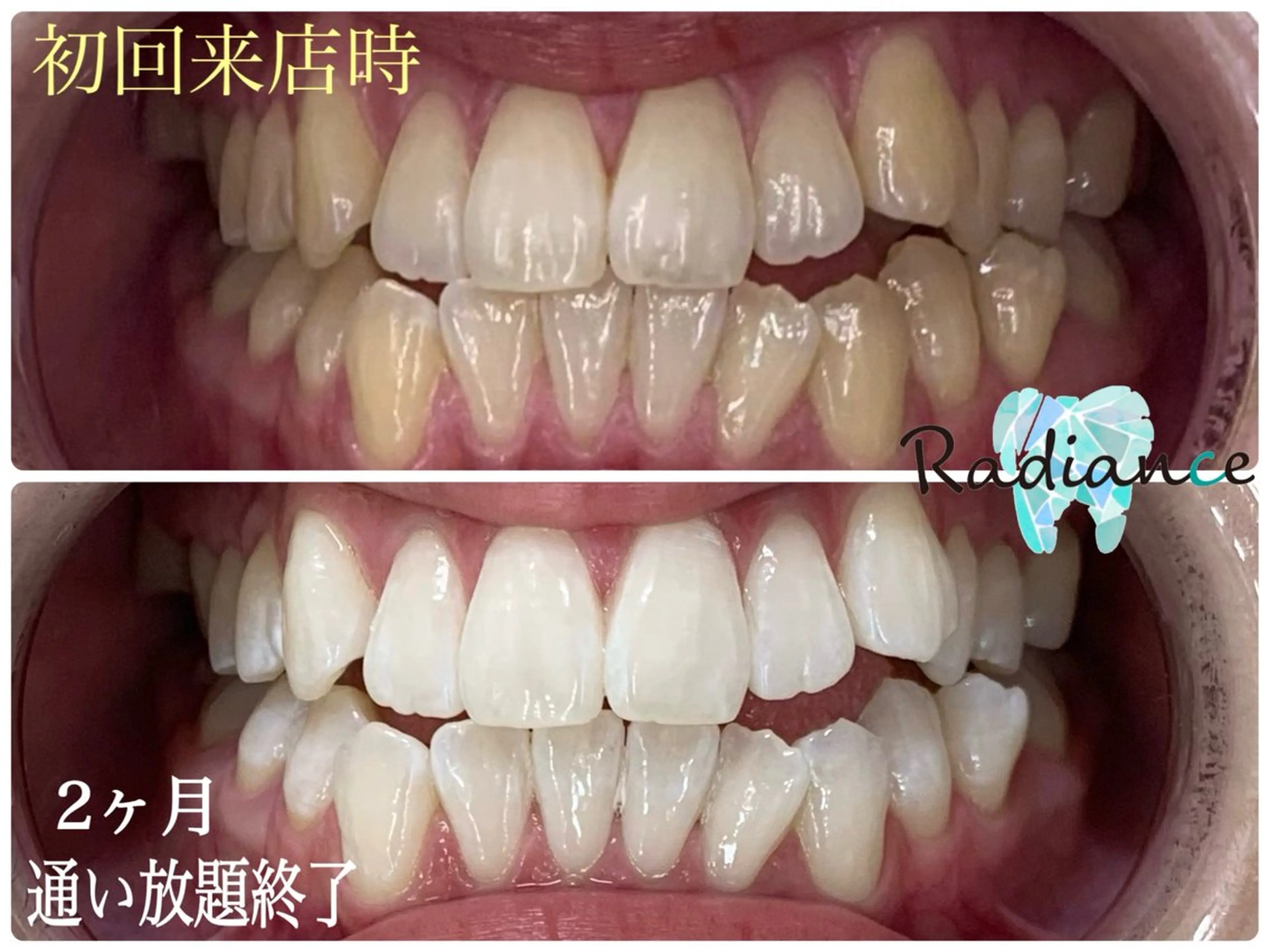 札幌ホワイトニング ラディアンス札幌駅店のその他イメージ