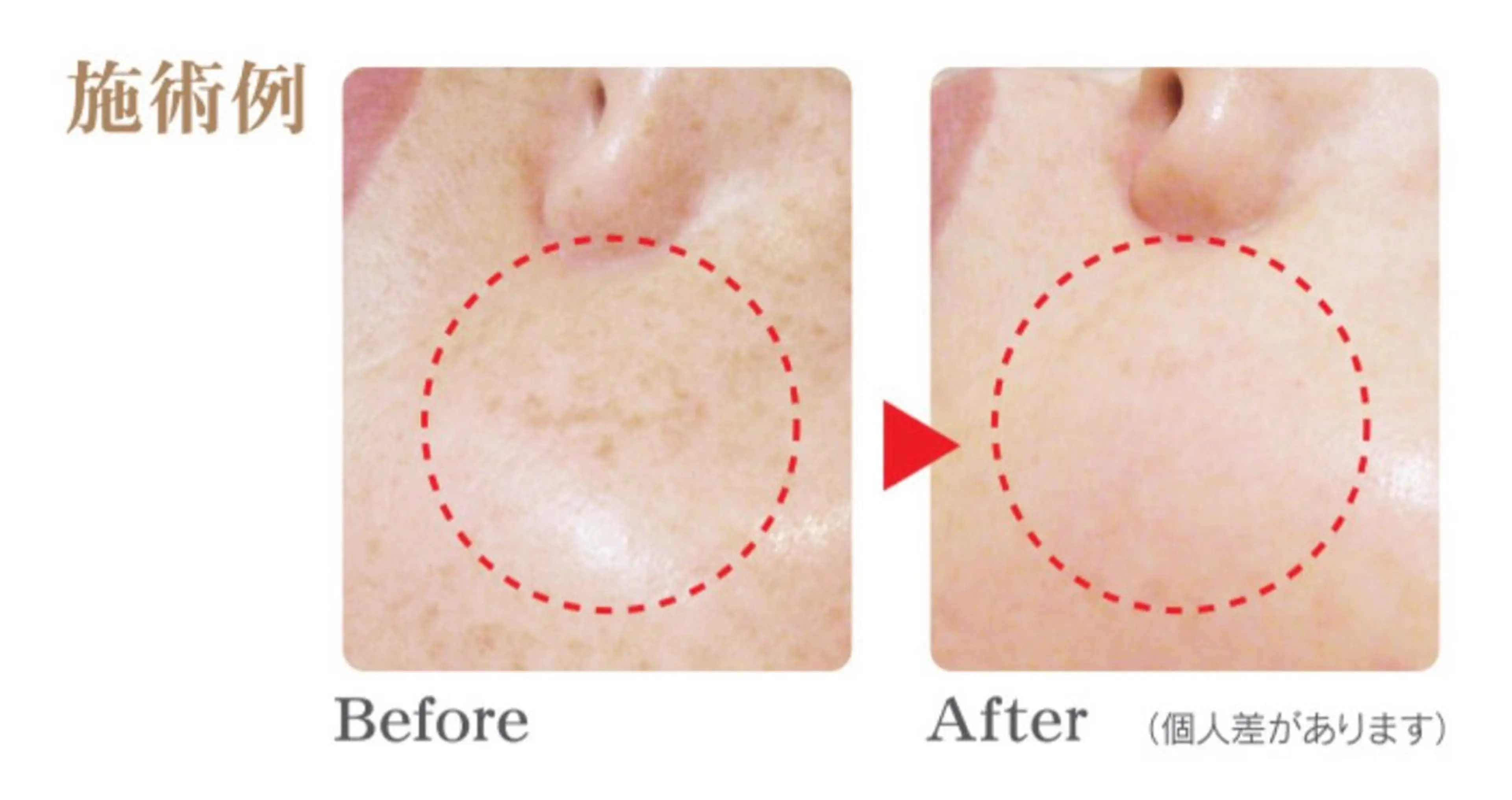 エステ シミケア Salon Mのエステ・リラクイメージ