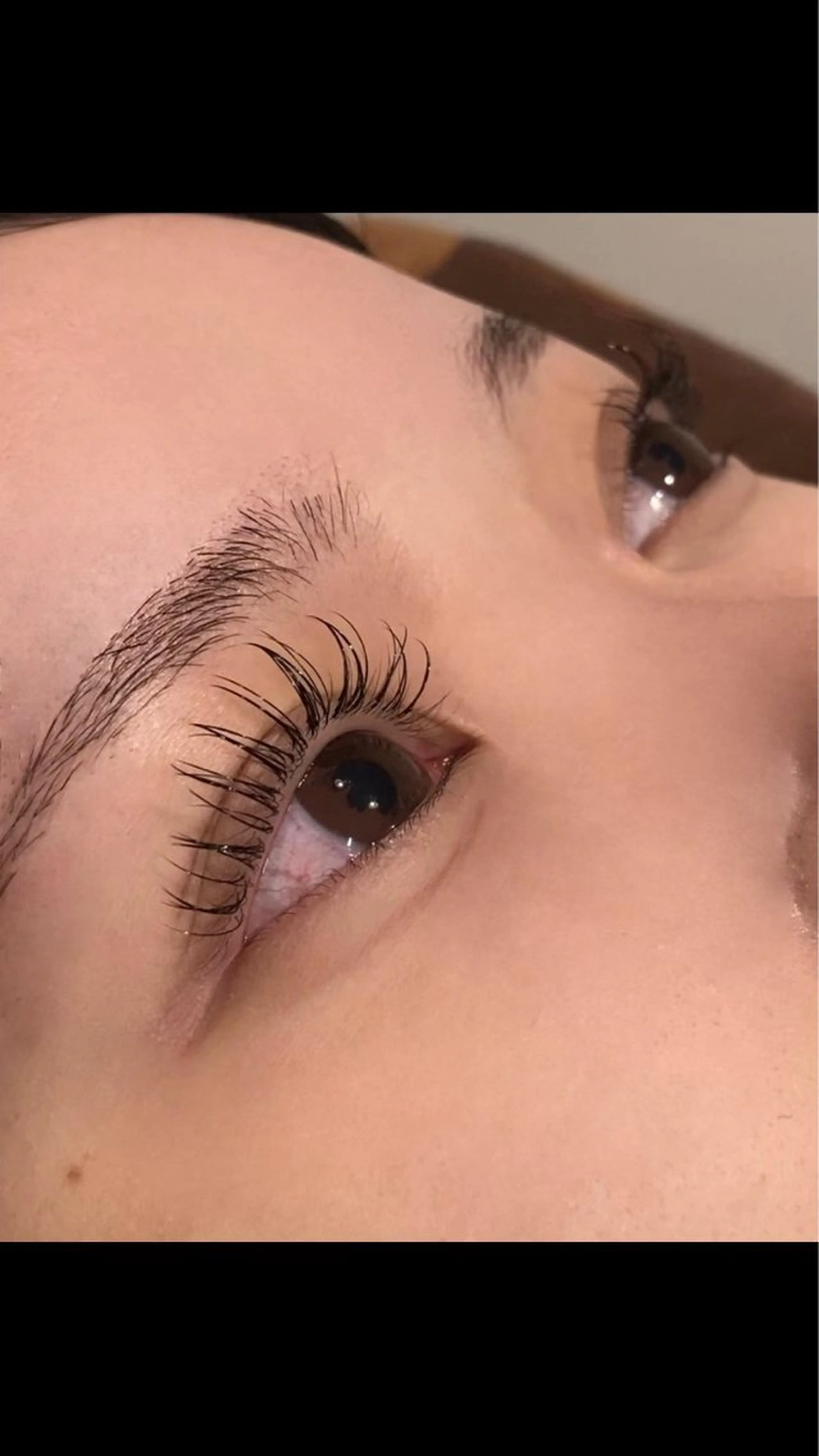 フラットマットラッシュ100本の写真