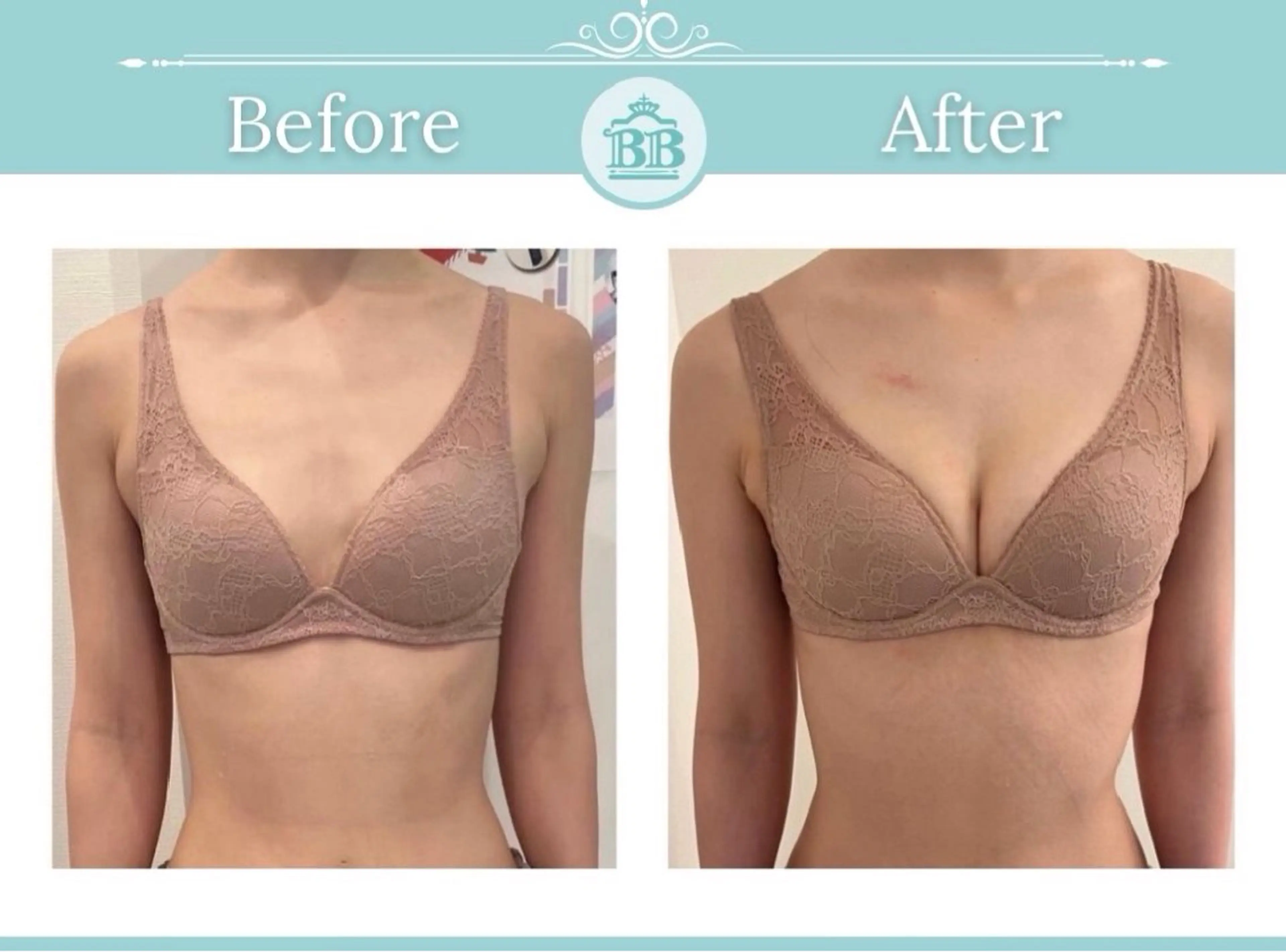 エステ 美人バスト本厚木店所属・美人バスト 本厚木店のエステ・リラクイメージ