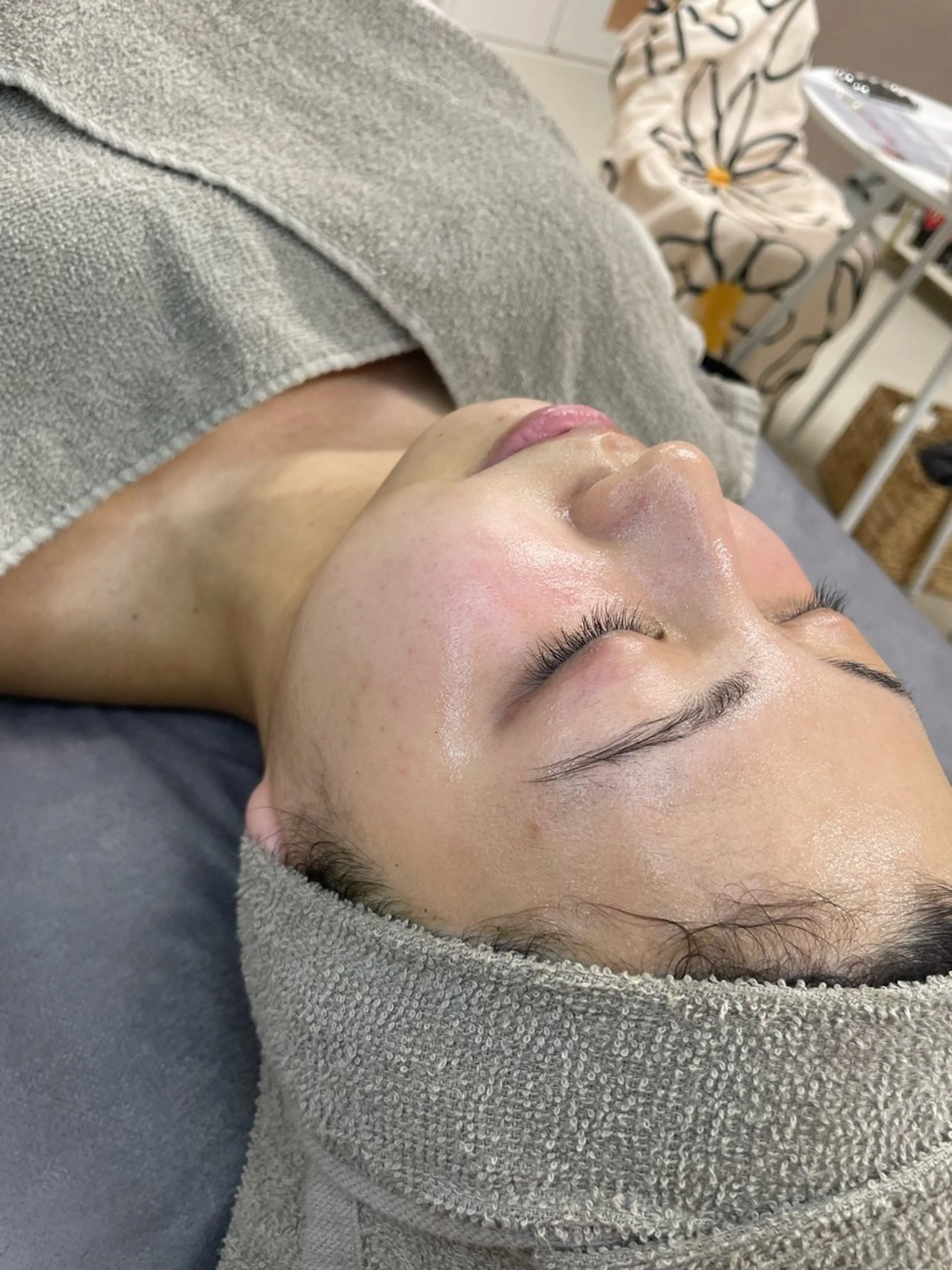 保湿、毛穴引き締め✨️美肌コース(ガス炭酸パック使用)の写真