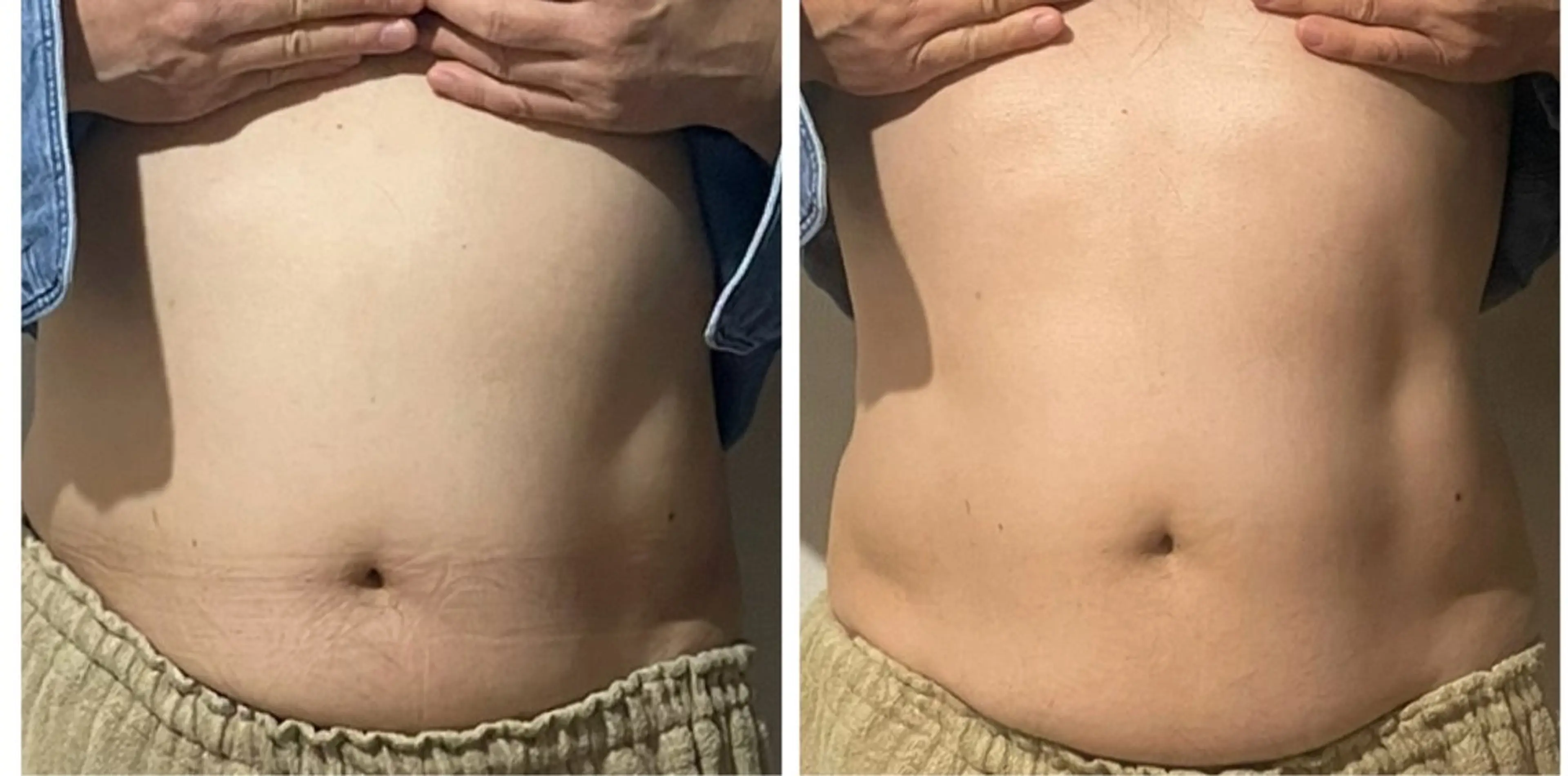 エステ 癒し腸もみサロン シャユーム　ゆきなのエステ・リラクイメージ