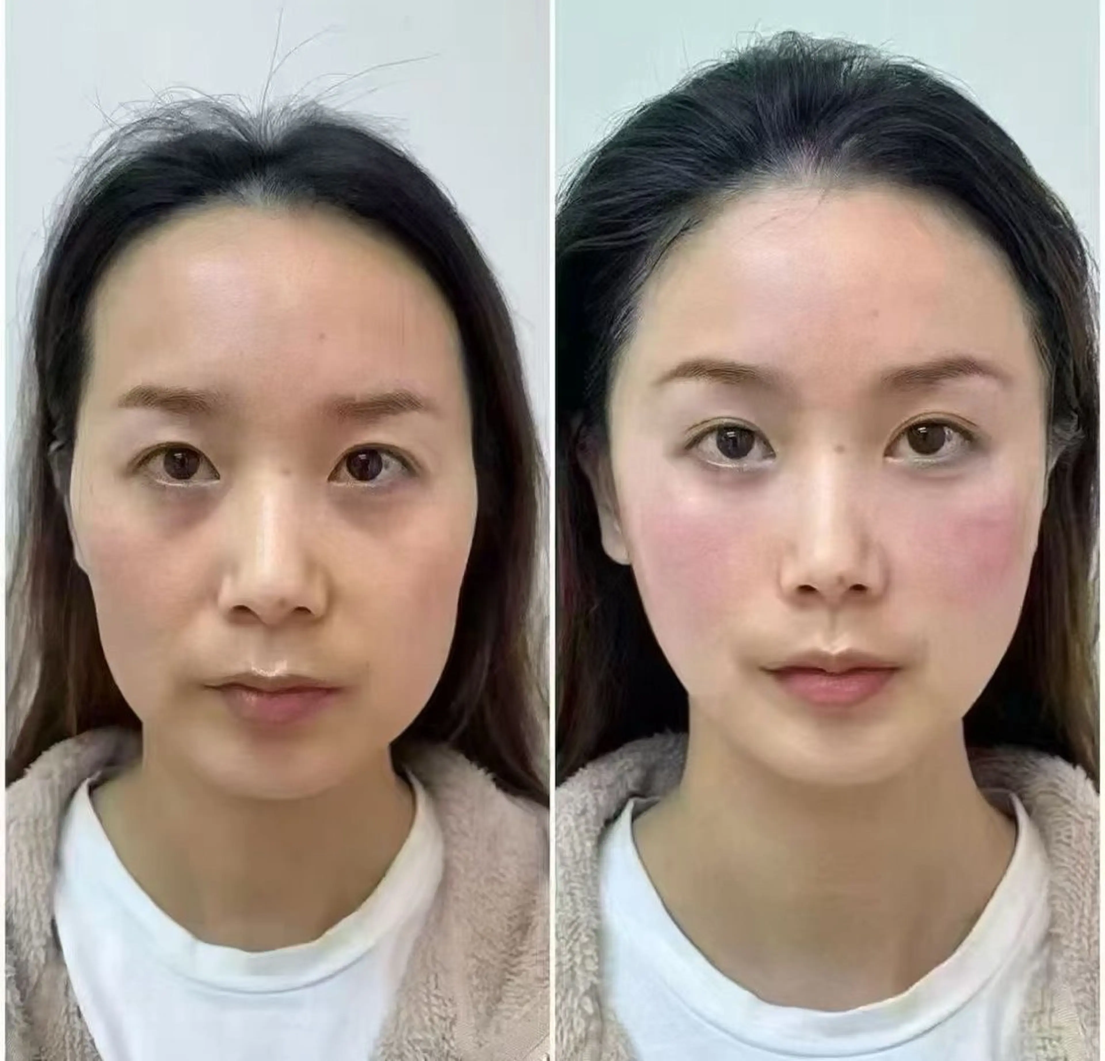 ネイル エステ aliaハイフ&水光ジェットサロン所属・aliaハーブ水光店 エステティシャン募集のエステ・リラクイメージ