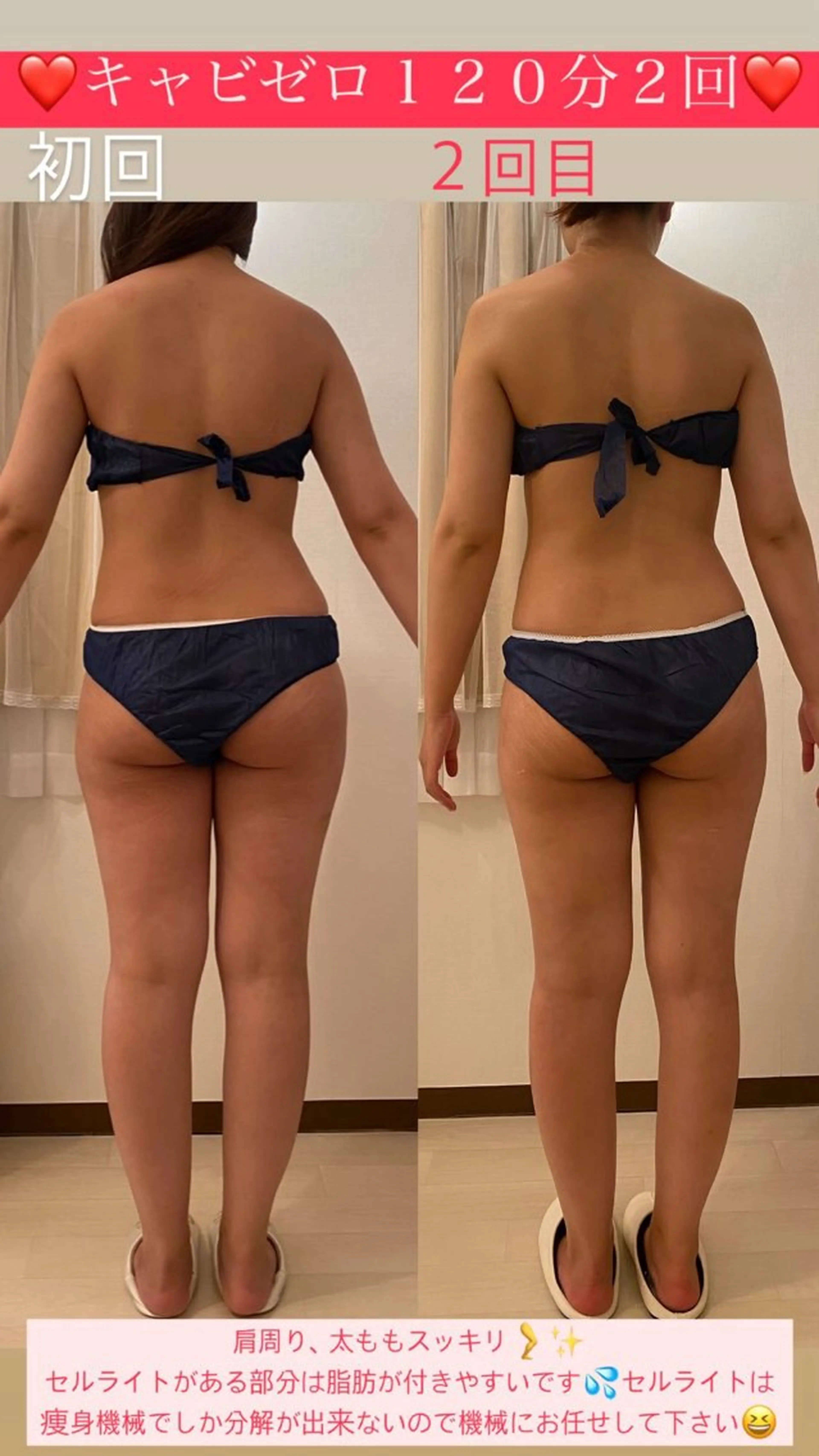 エステ Salon de Lino 御器所のエステ・リラクイメージ