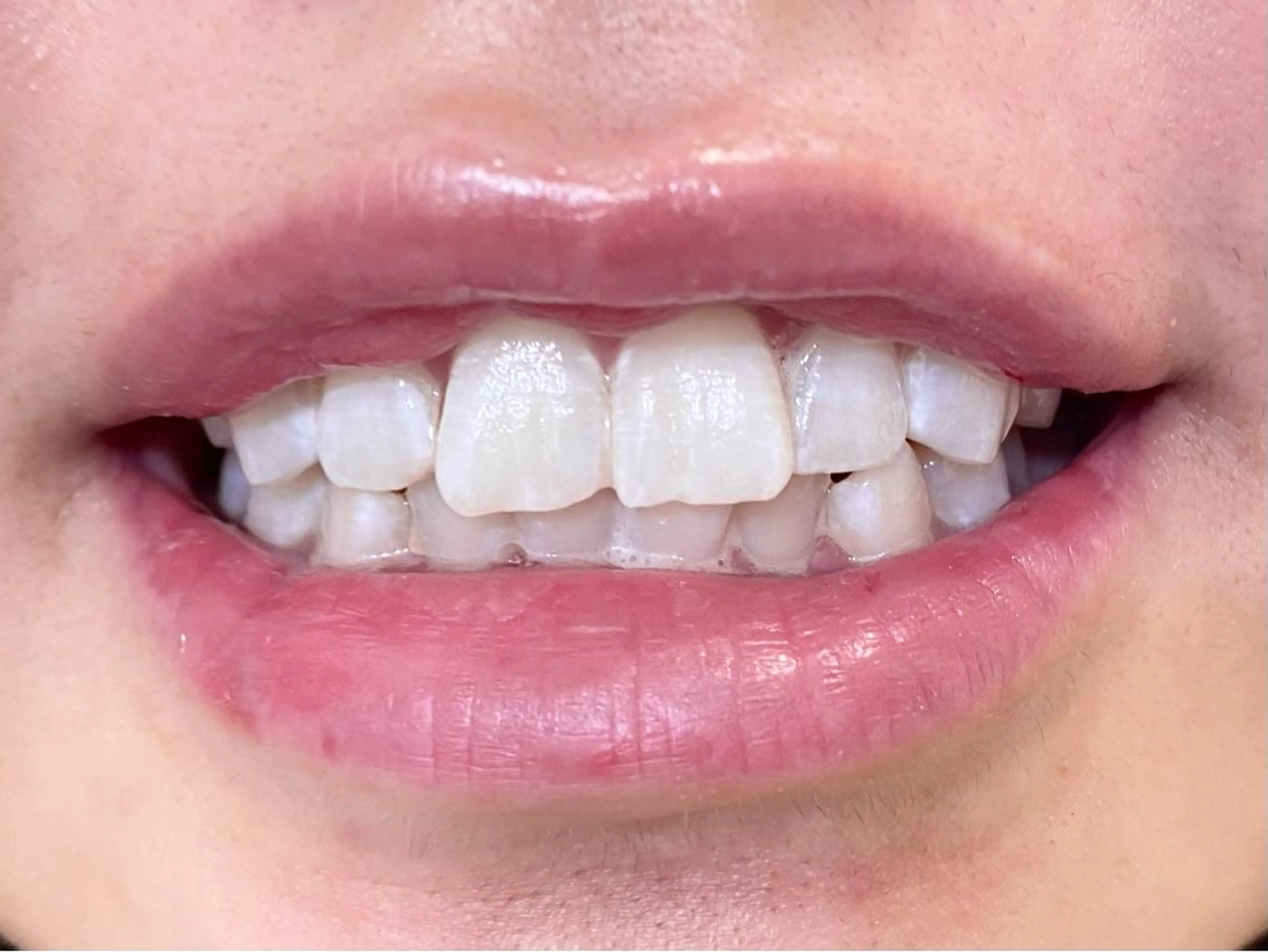 セルフホワイトニングサロン　ラヴィアン所属・ホワイトニングサロン La vie enのその他イメージ