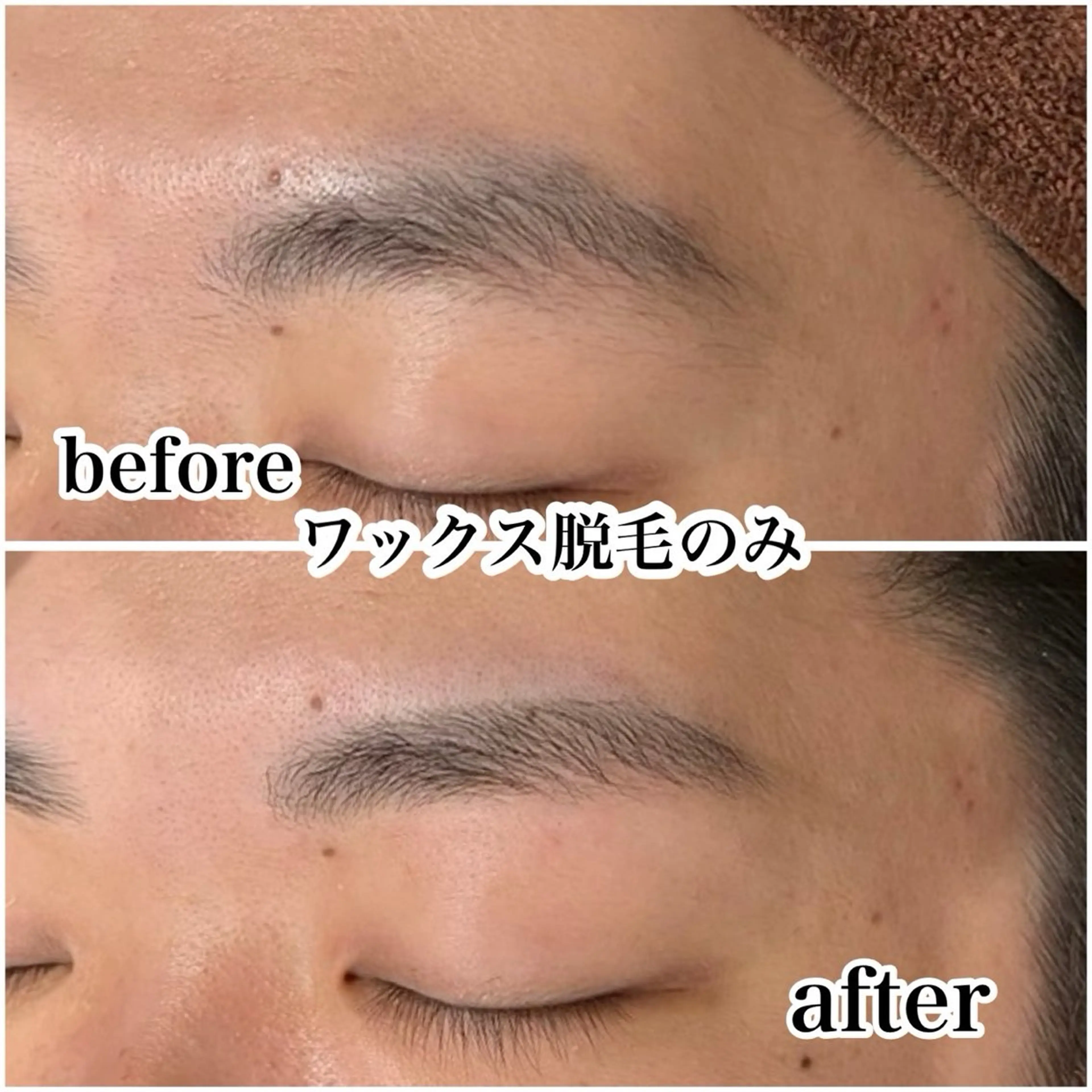 【男の美眉/眉毛メンテナンス】5500→1650 ［ワックス脱毛/メンズアイブロウ/メンズ眉毛/横浜］の写真