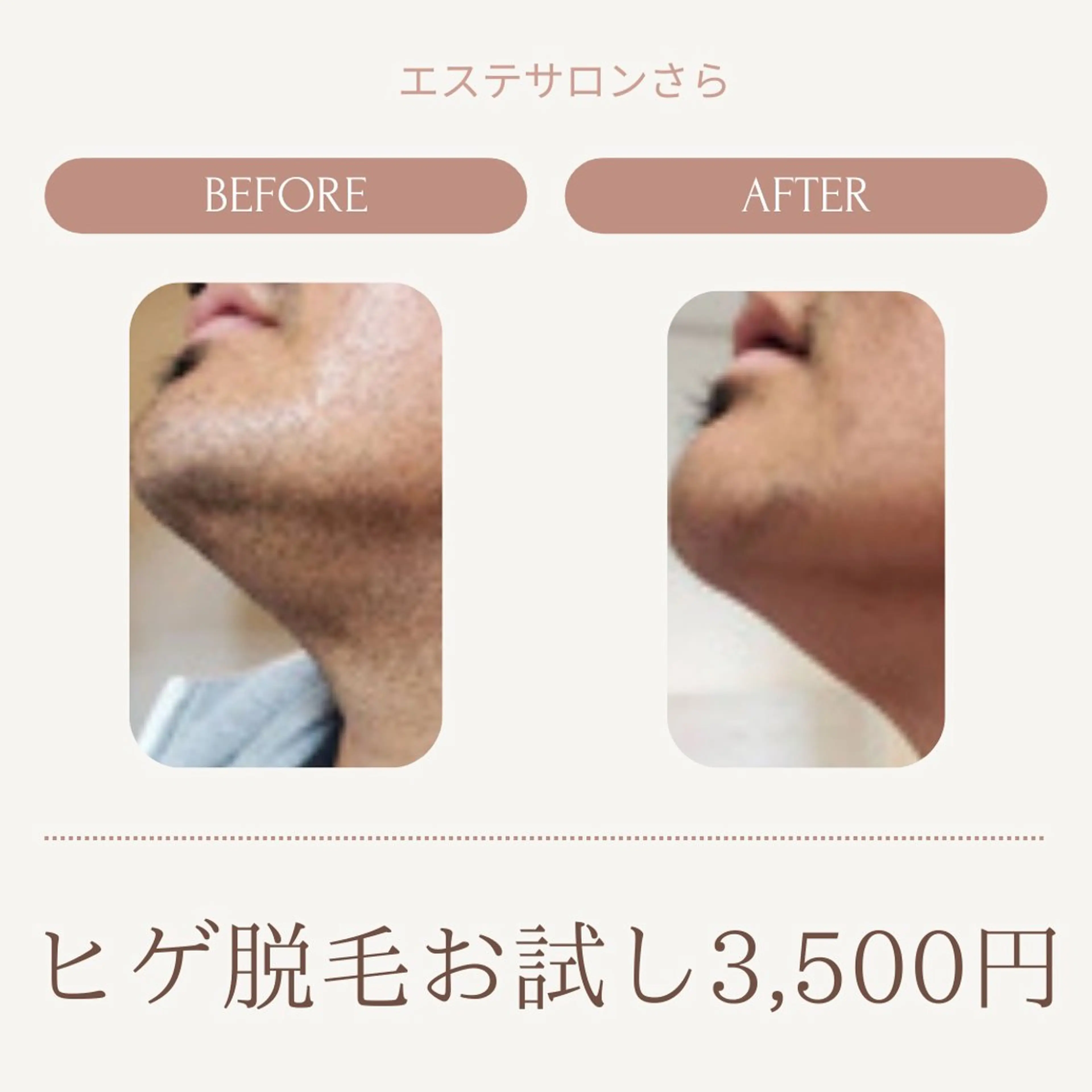 エステサロンさら所属・エステサロン さらのエステ・リラクイメージ