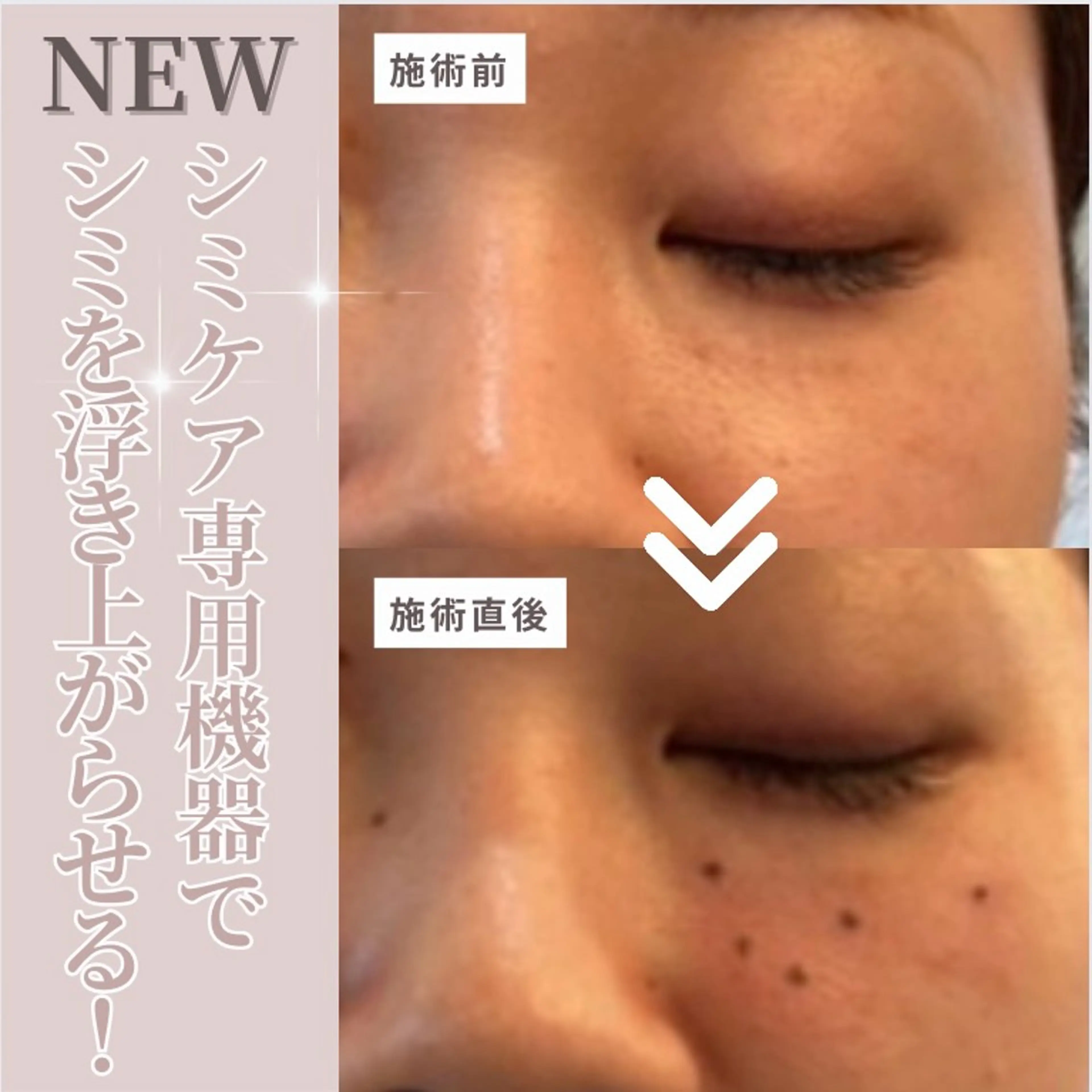 エステ ResetLab 佐藤 風香のエステ・リラクイメージ