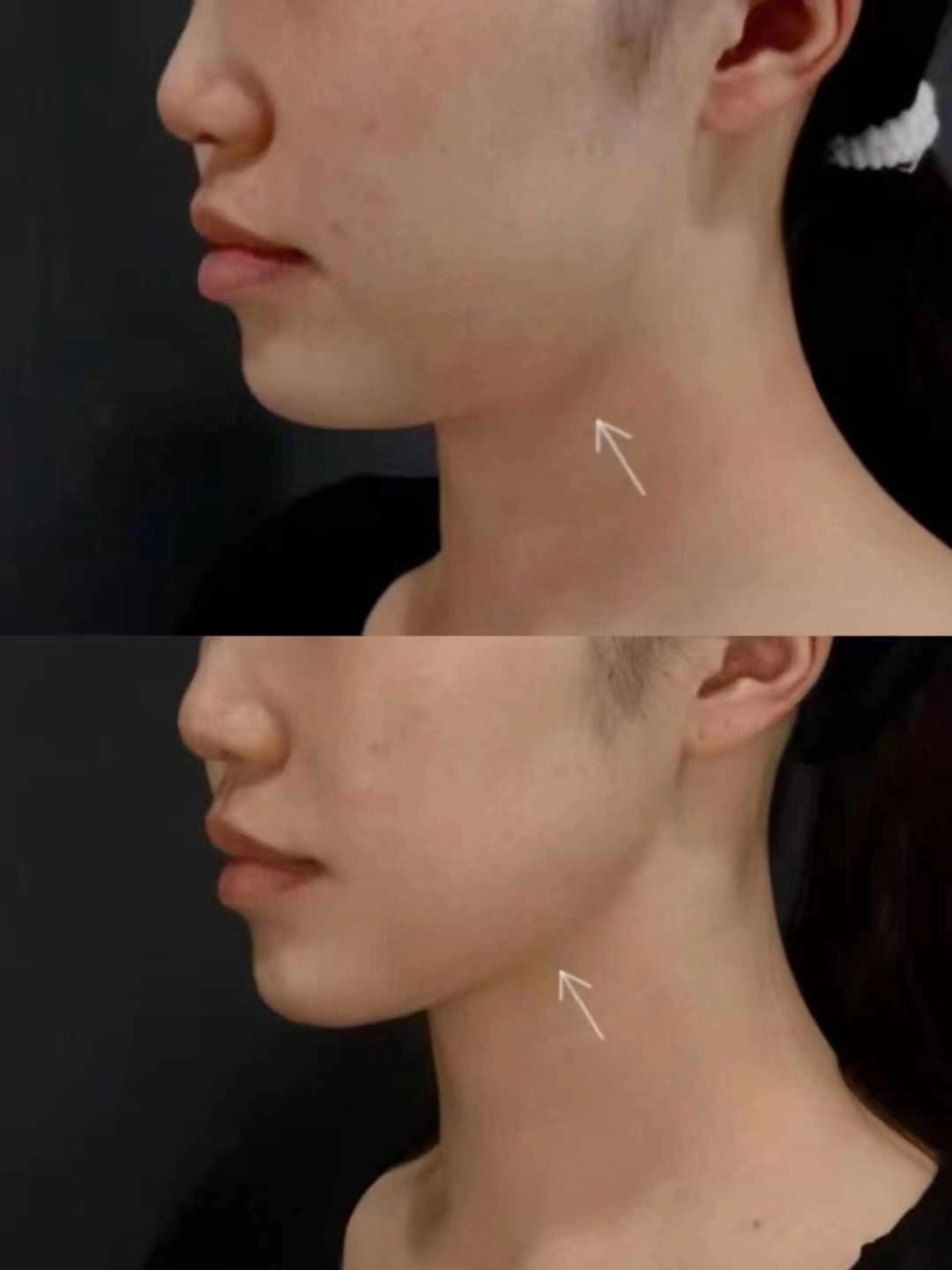 ネイル エステ aliaハイフ&水光ジェットサロン所属・aliaハーブ水光店 エステティシャン募集のエステ・リラクイメージ