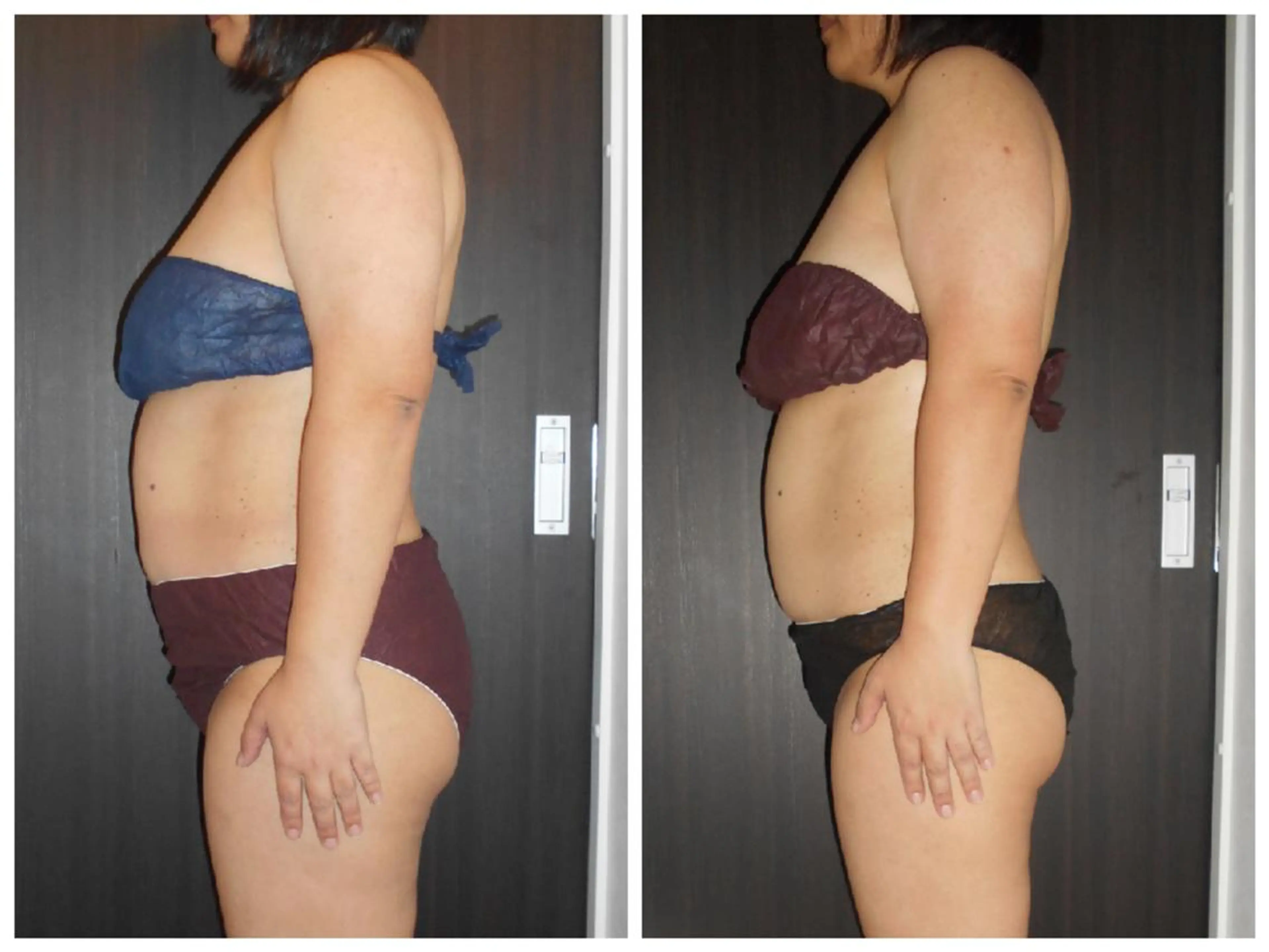 痩身専門店 イオンモール春日部店のエステ・リラクイメージ