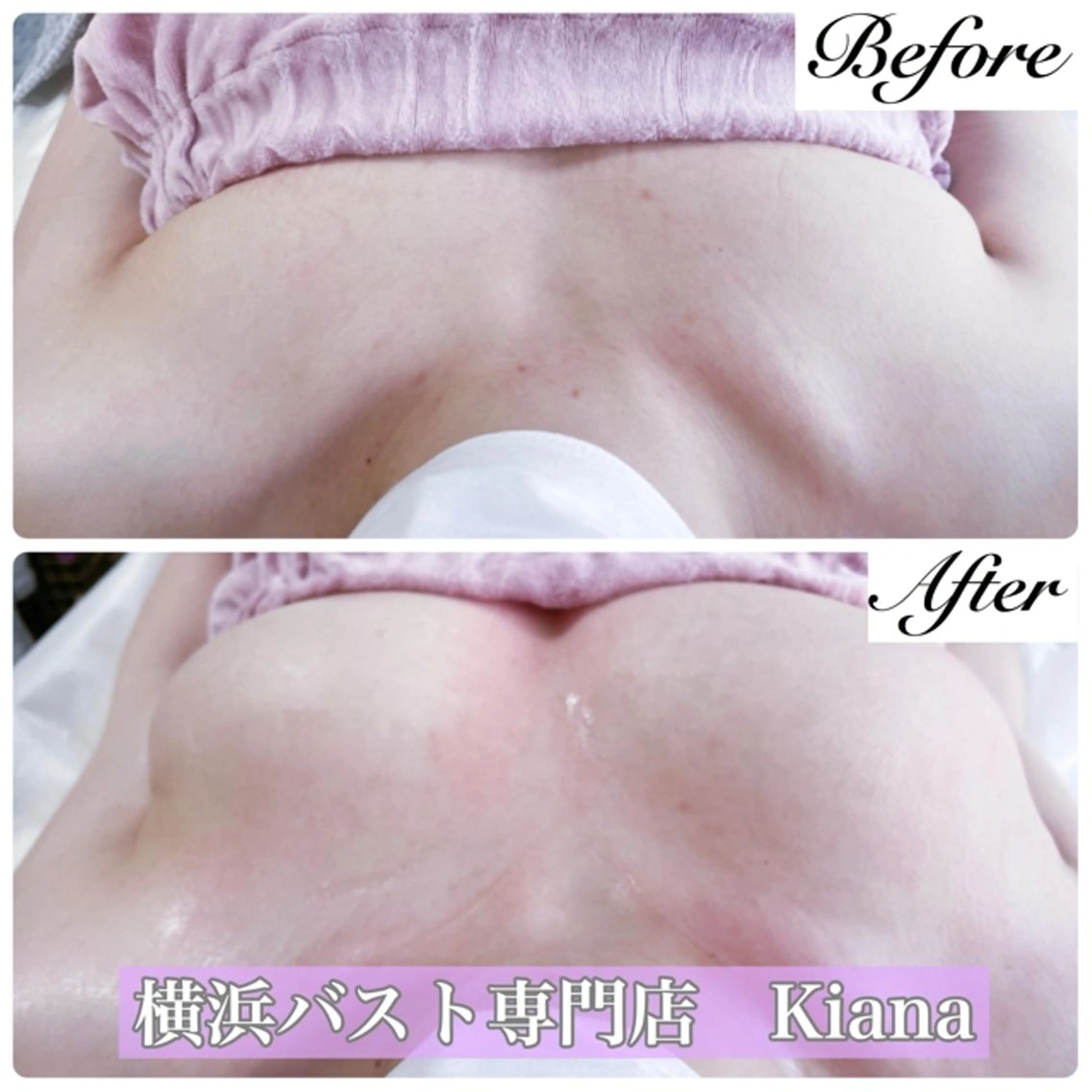 バストケア　オーダーメイド施術80分　¥16500→¥8000の写真