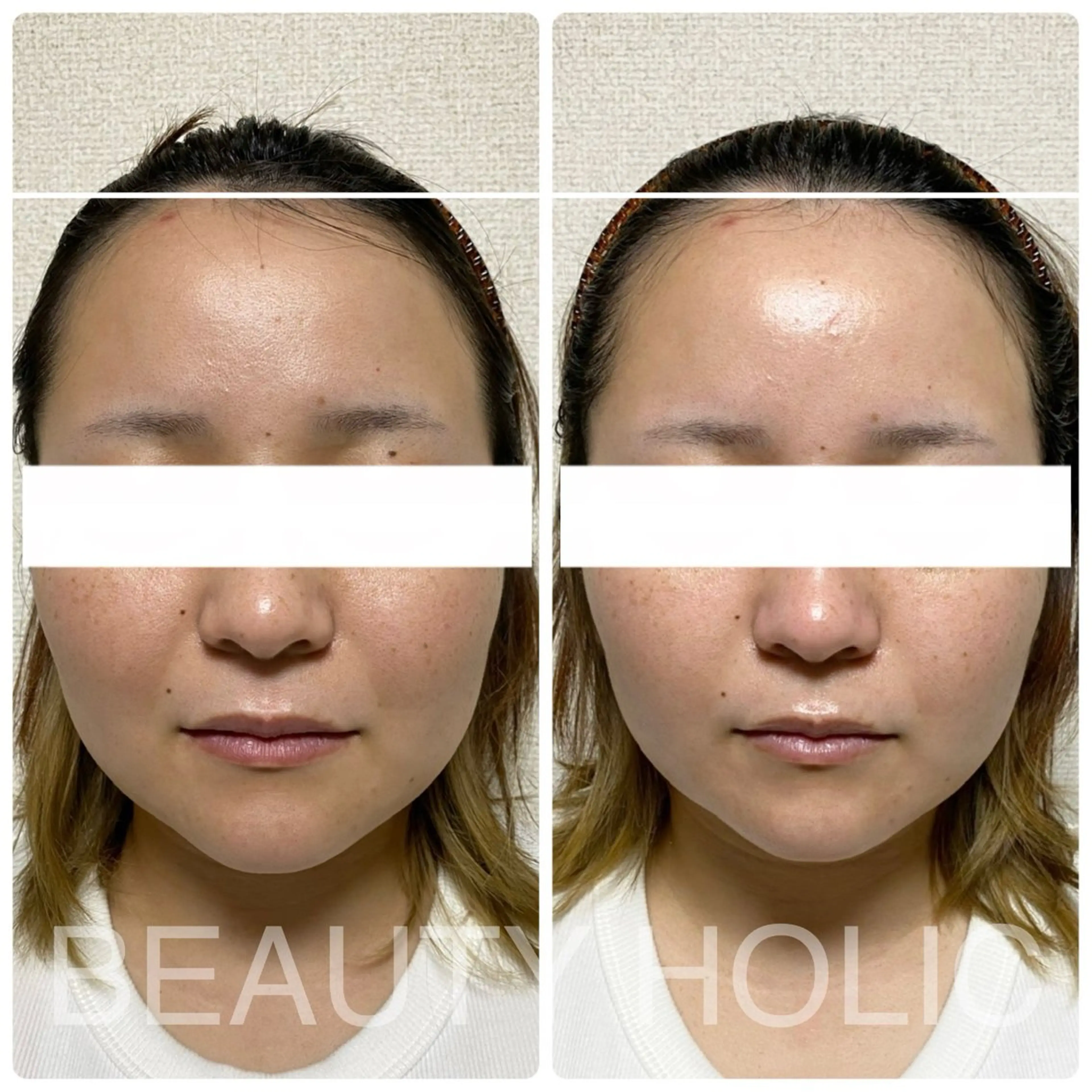 ビューティーホリック 東金店のエステ・リラクイメージ