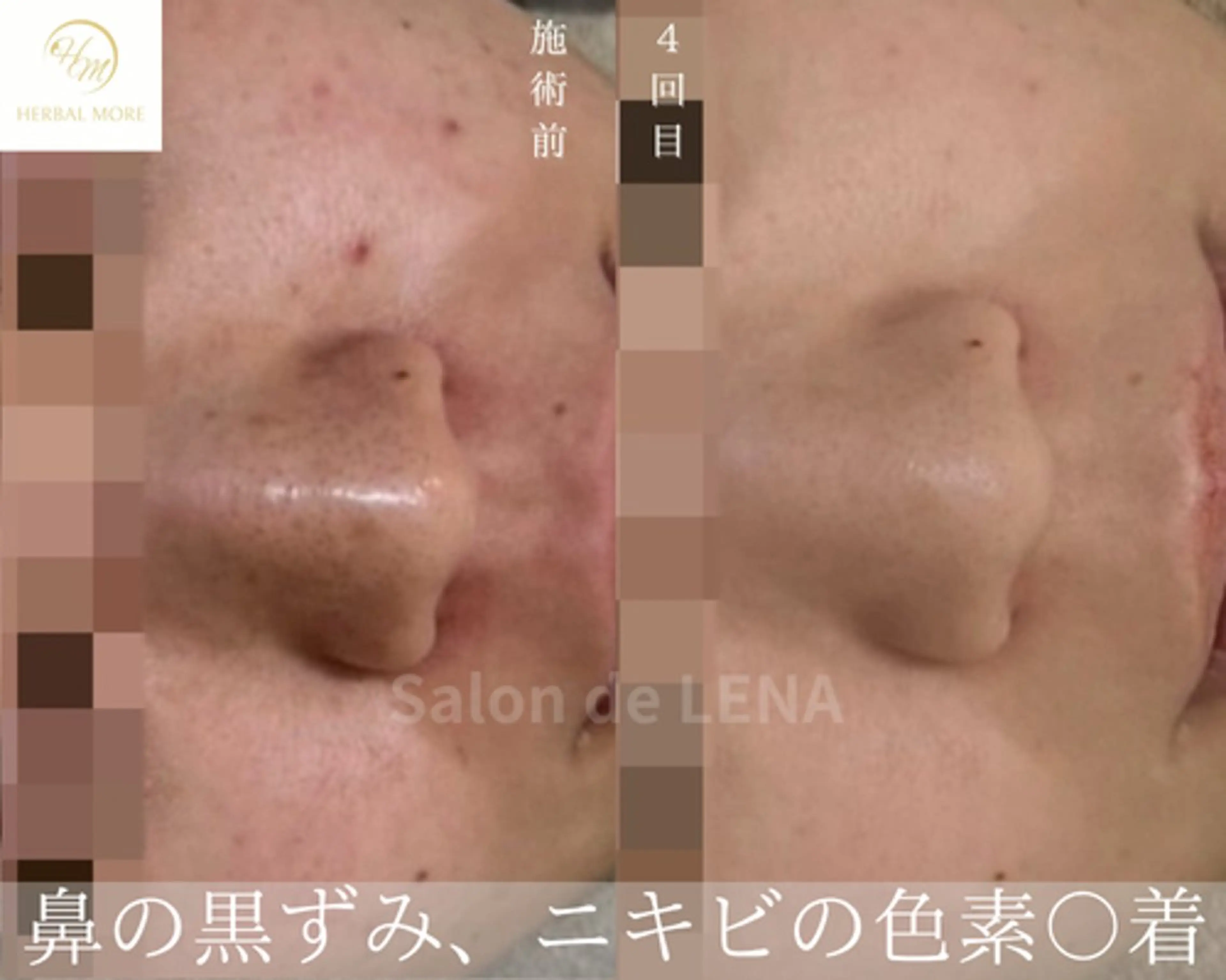 ハーブピーリング・毛穴ケア専門サロンSalon de LENA 栄店所属・ハーブピーリング専門 サロンドレナ　白藤のエステ・リラクイメージ