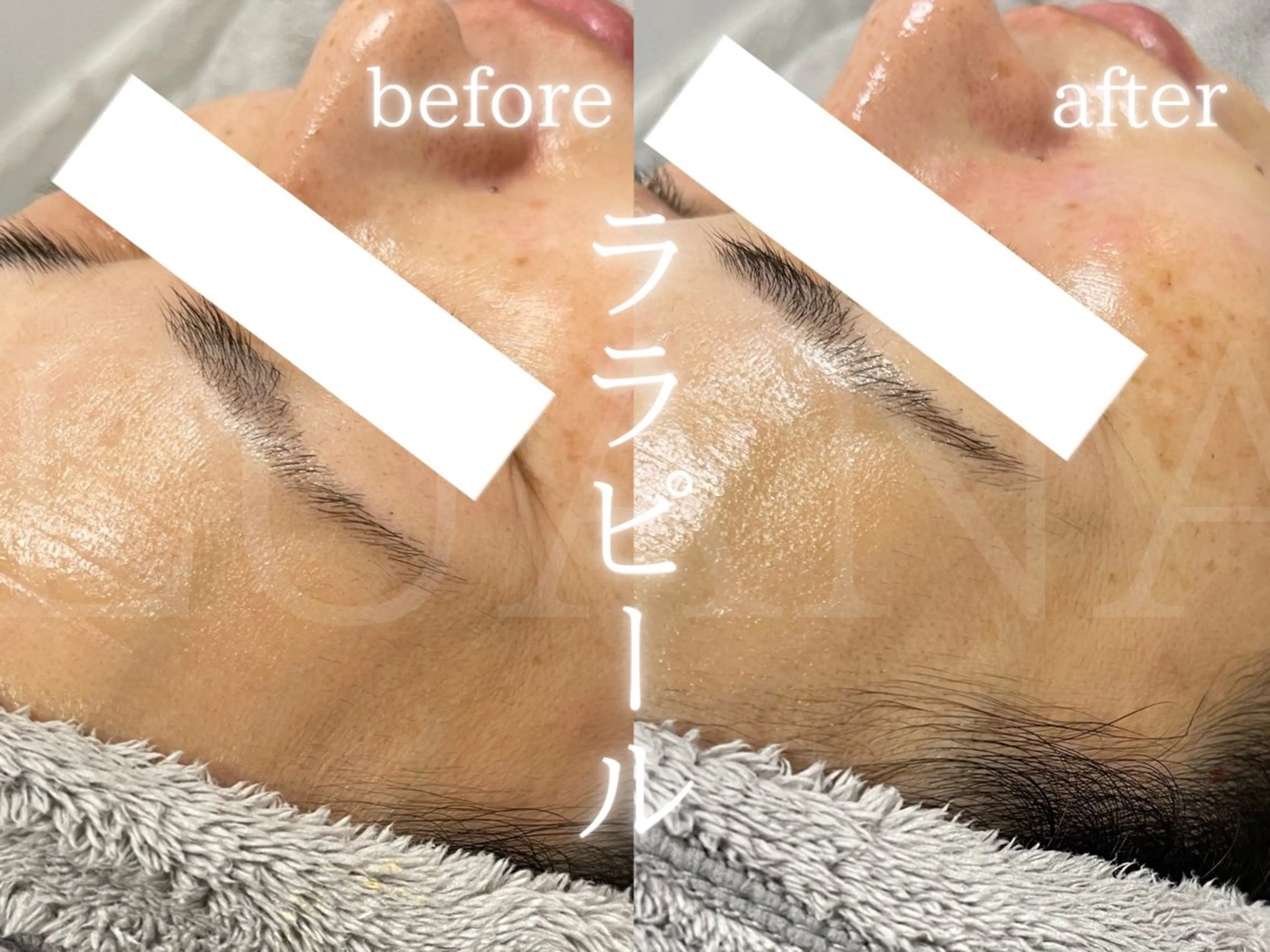 エステ LUANA TAKAGIの眉毛・アイブロウイメージ