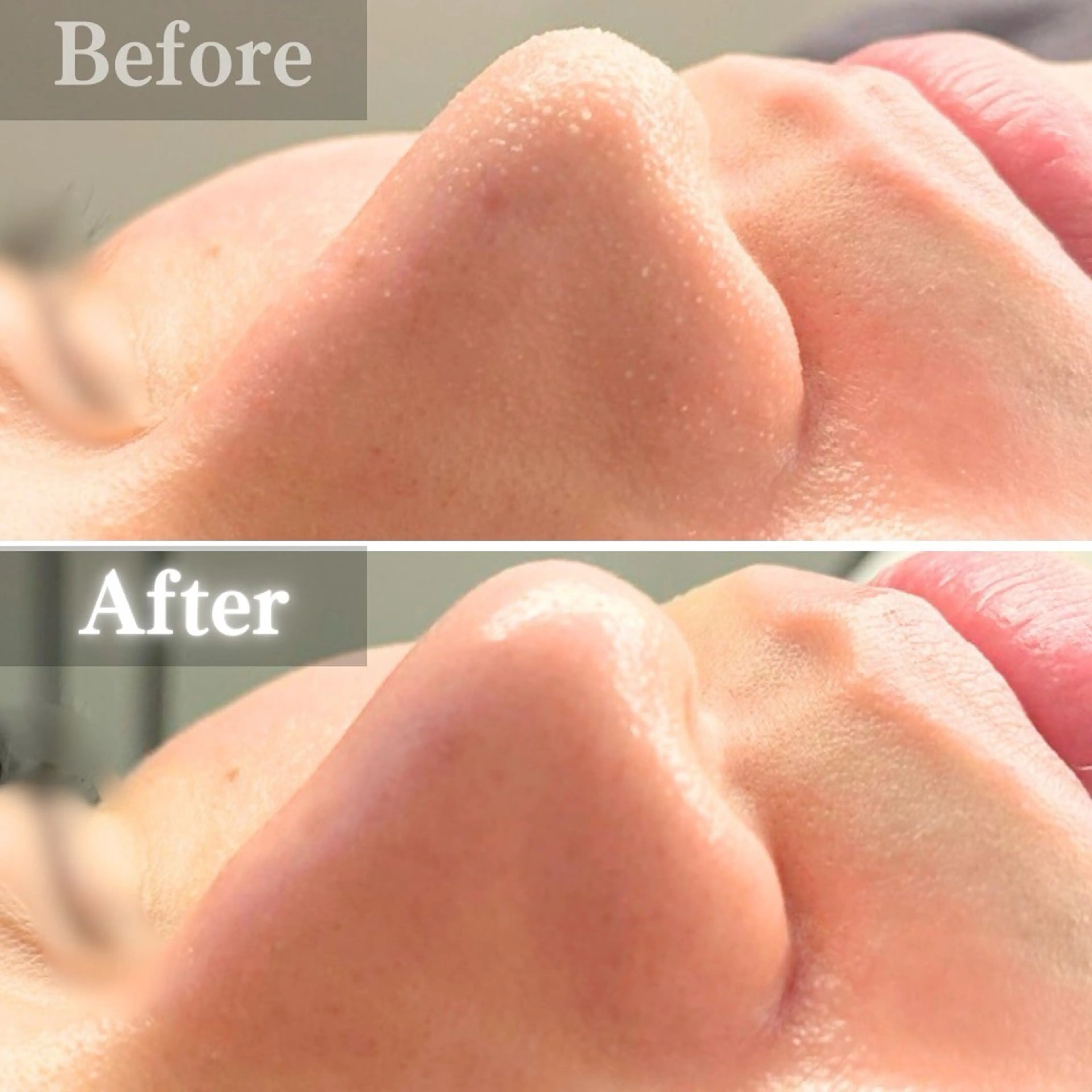 エステ 毛穴洗浄特化🫧 オオツカのエステ・リラクイメージ