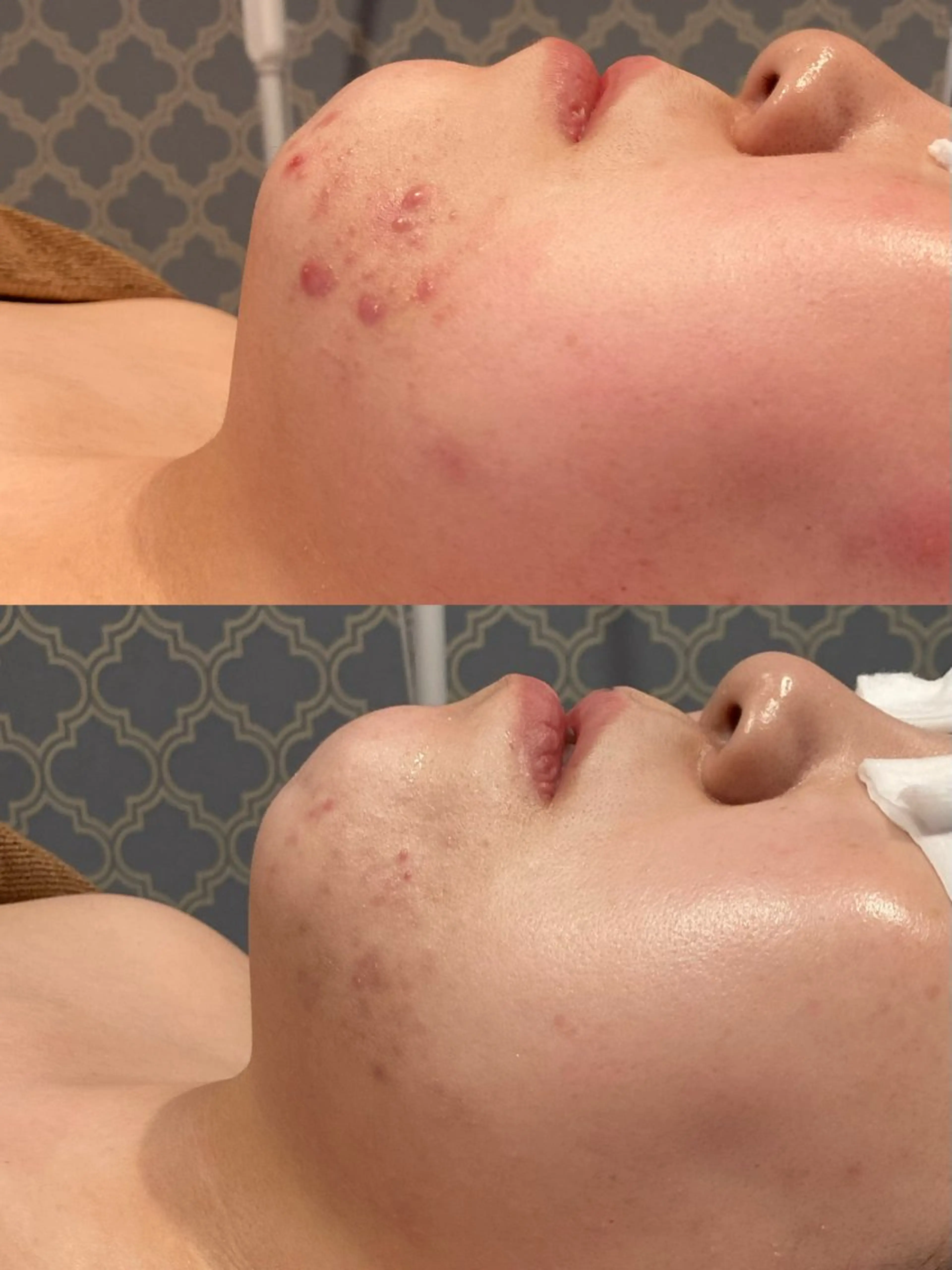 エステ SA KIのマツエク・マツパデザイン