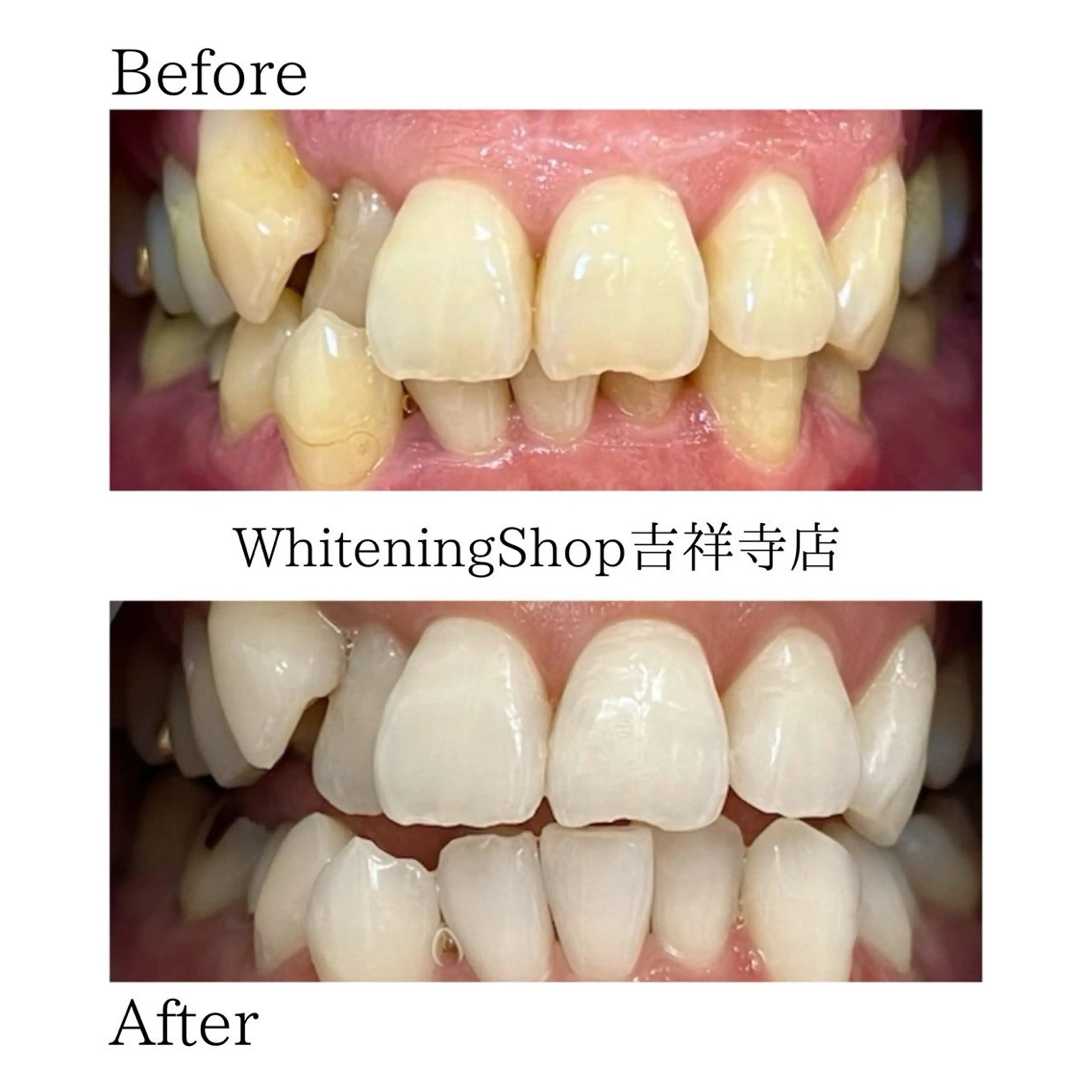 ホワイトニング ショップ吉祥寺店のエステ・リラクイメージ