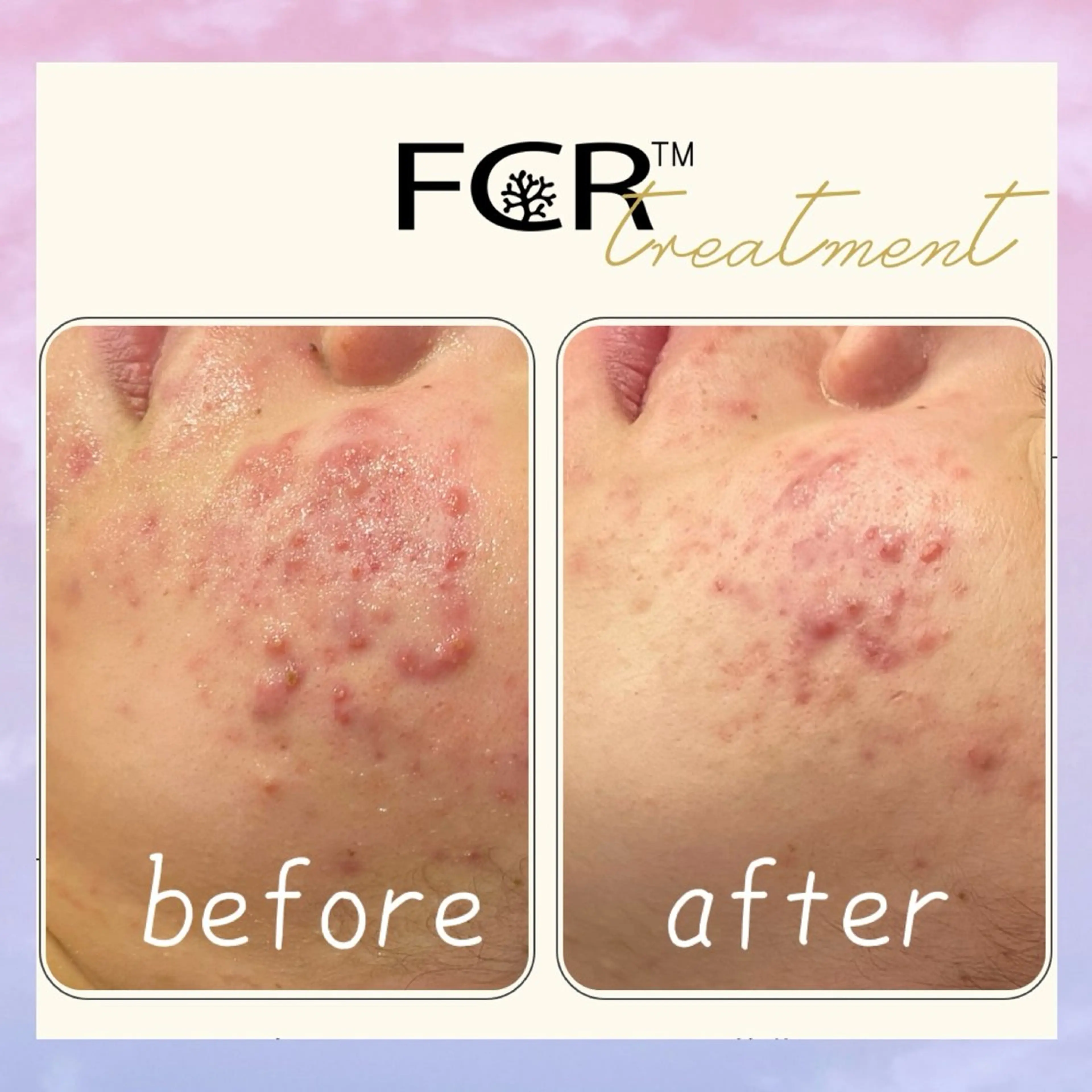 肌質改善Charme coco 増毛のエステ・リラクイメージ