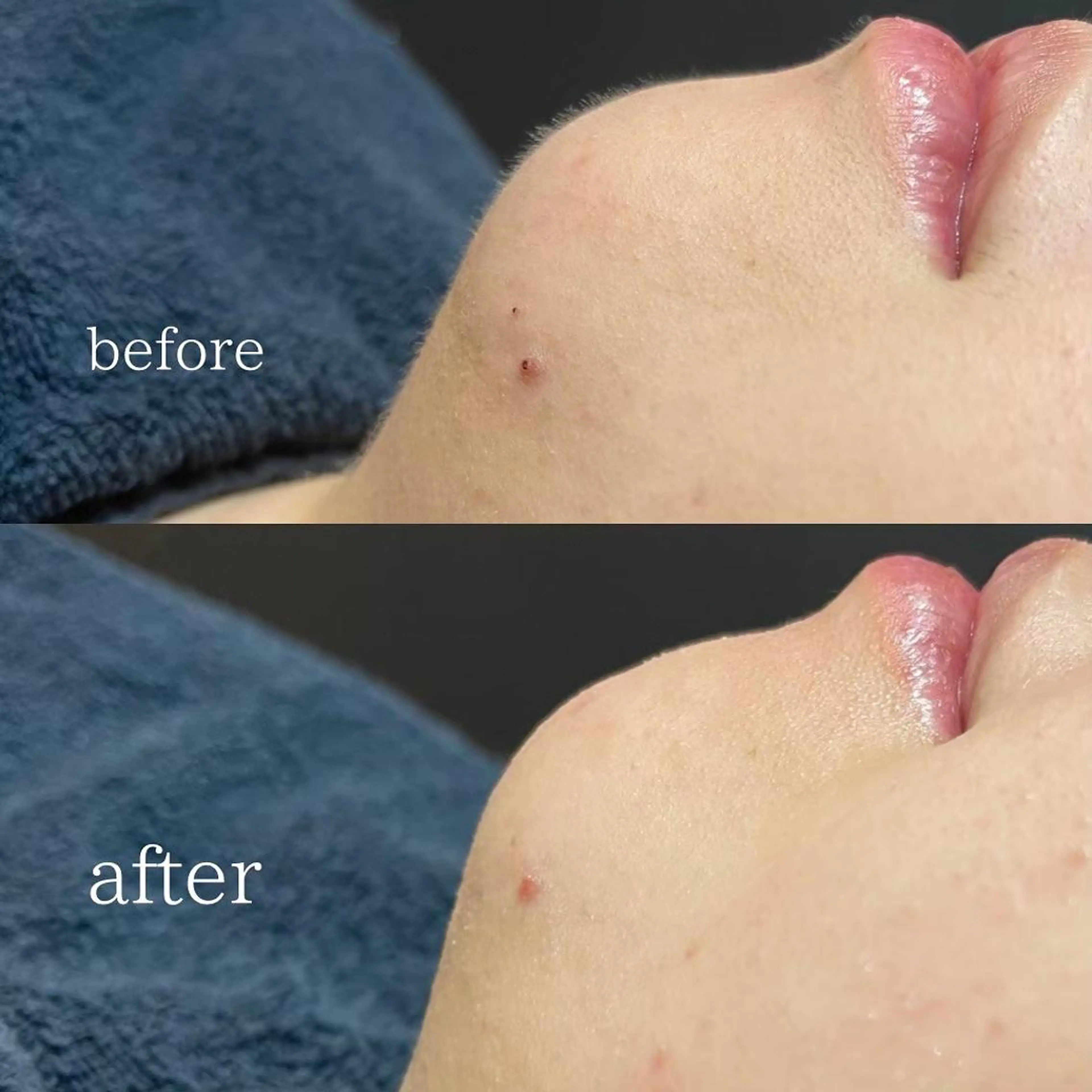 🫧美しい素肌へ🫧 今成柚乃のその他イメージ