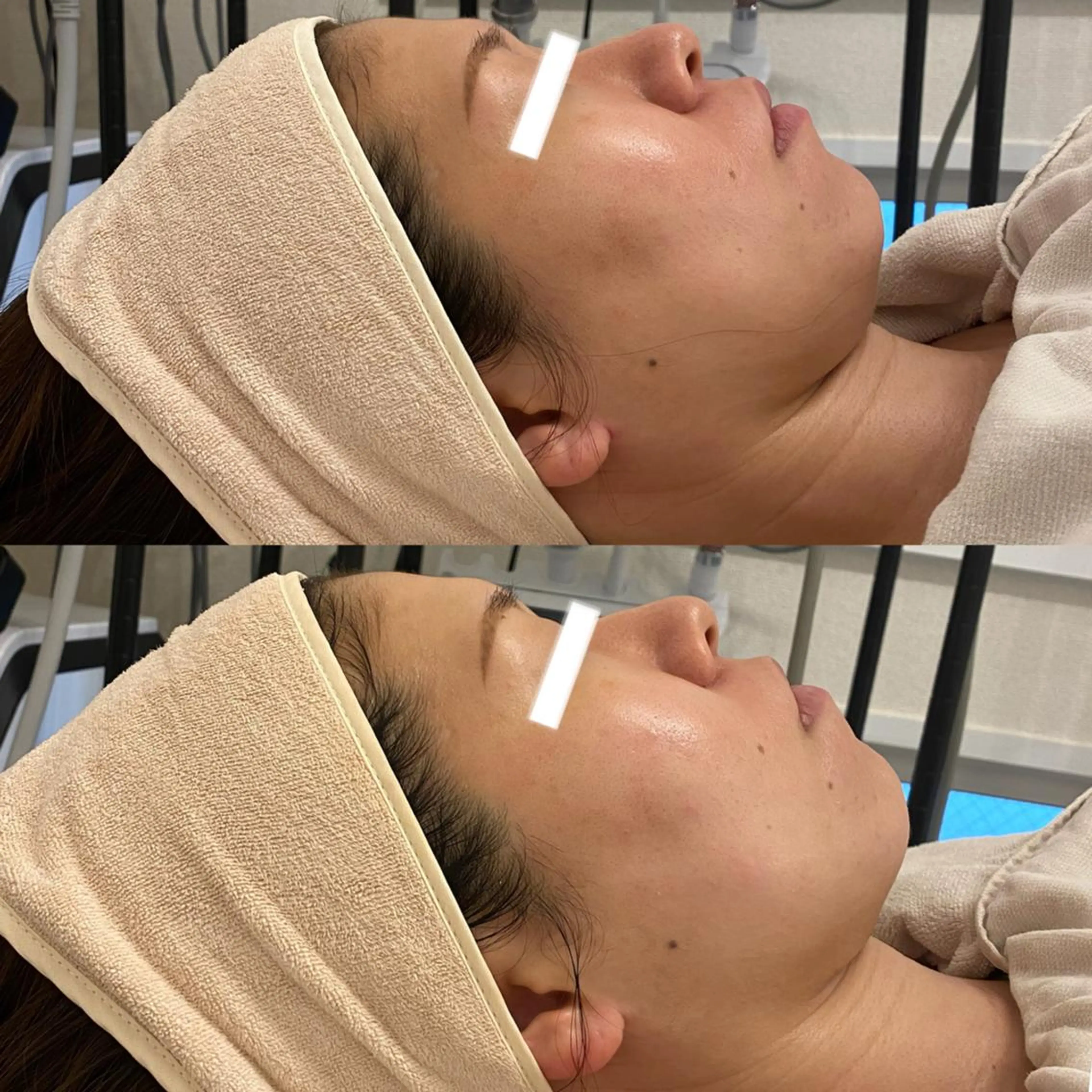 エステ ✨美肌水光✨ アトリエリュバンのエステ・リラクイメージ