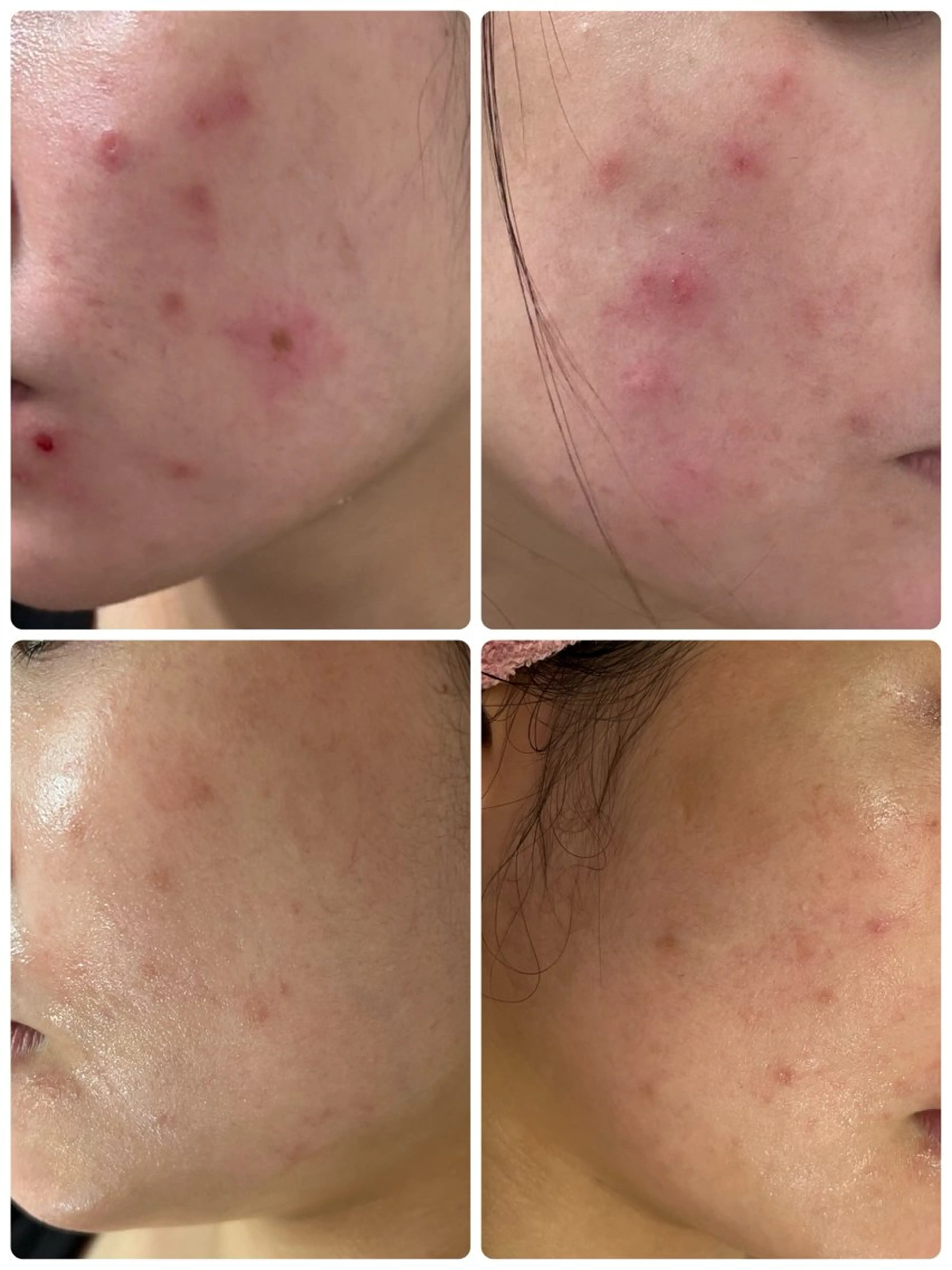 CEサロンbelle mona所属・CEサロン belle monaのエステ・リラクイメージ