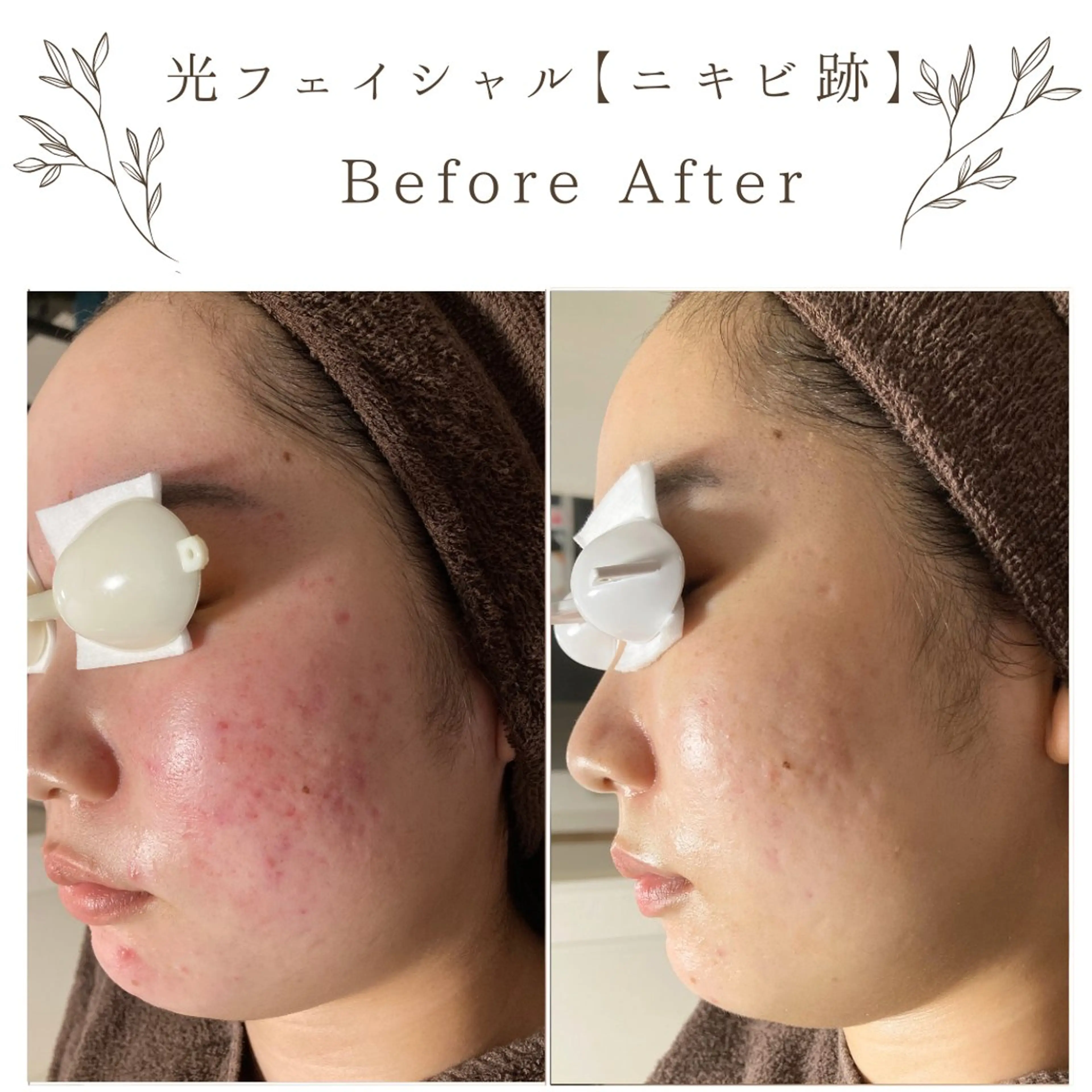 な ぎのエステ・リラクイメージ