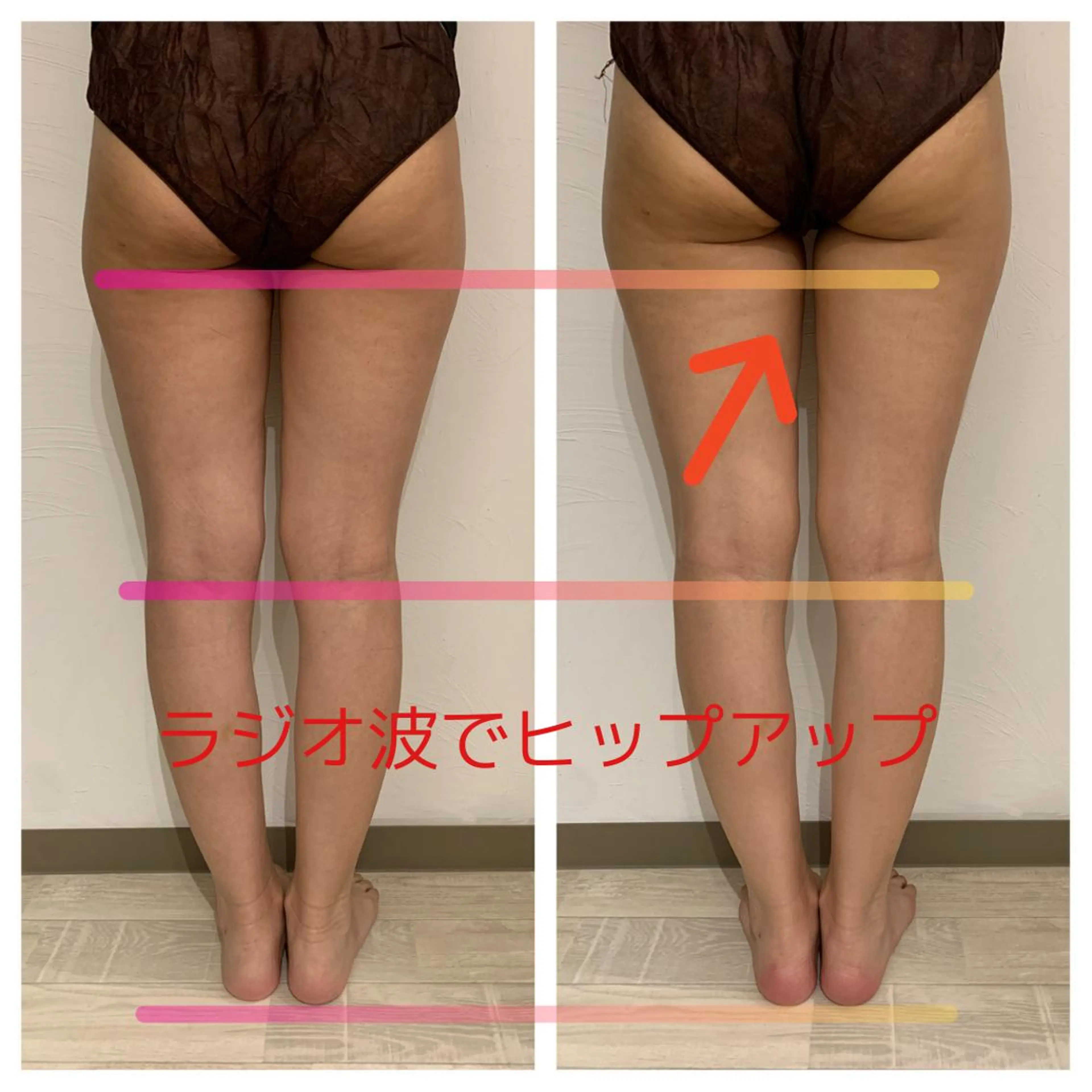 リンパマッサージ&ピラティスmimoza所属・リンパマッサージ mimozaのエステ・リラクイメージ