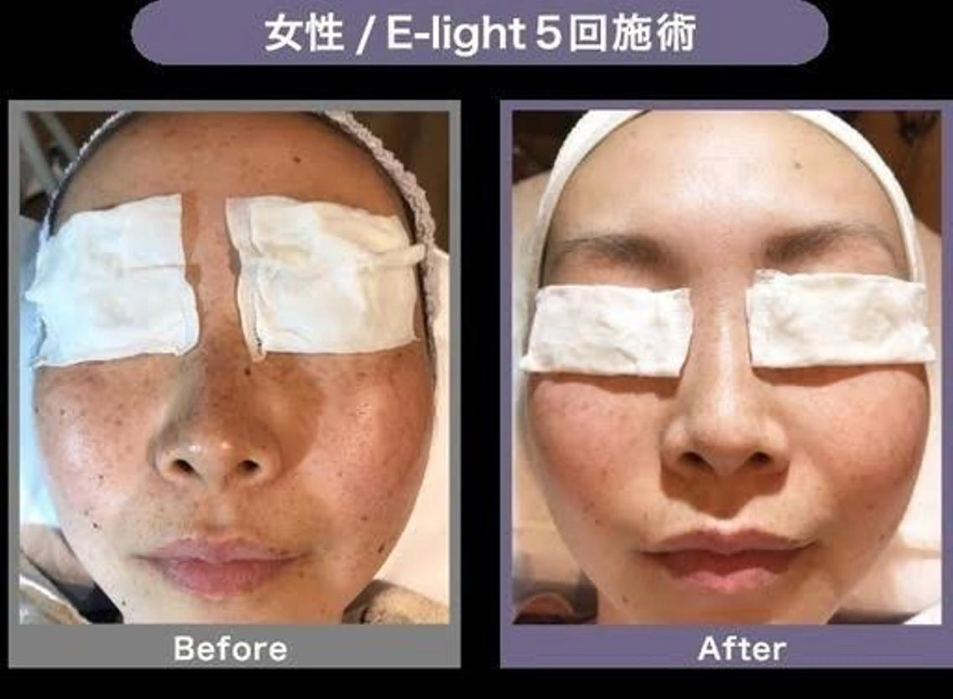 precious みきのその他イメージ