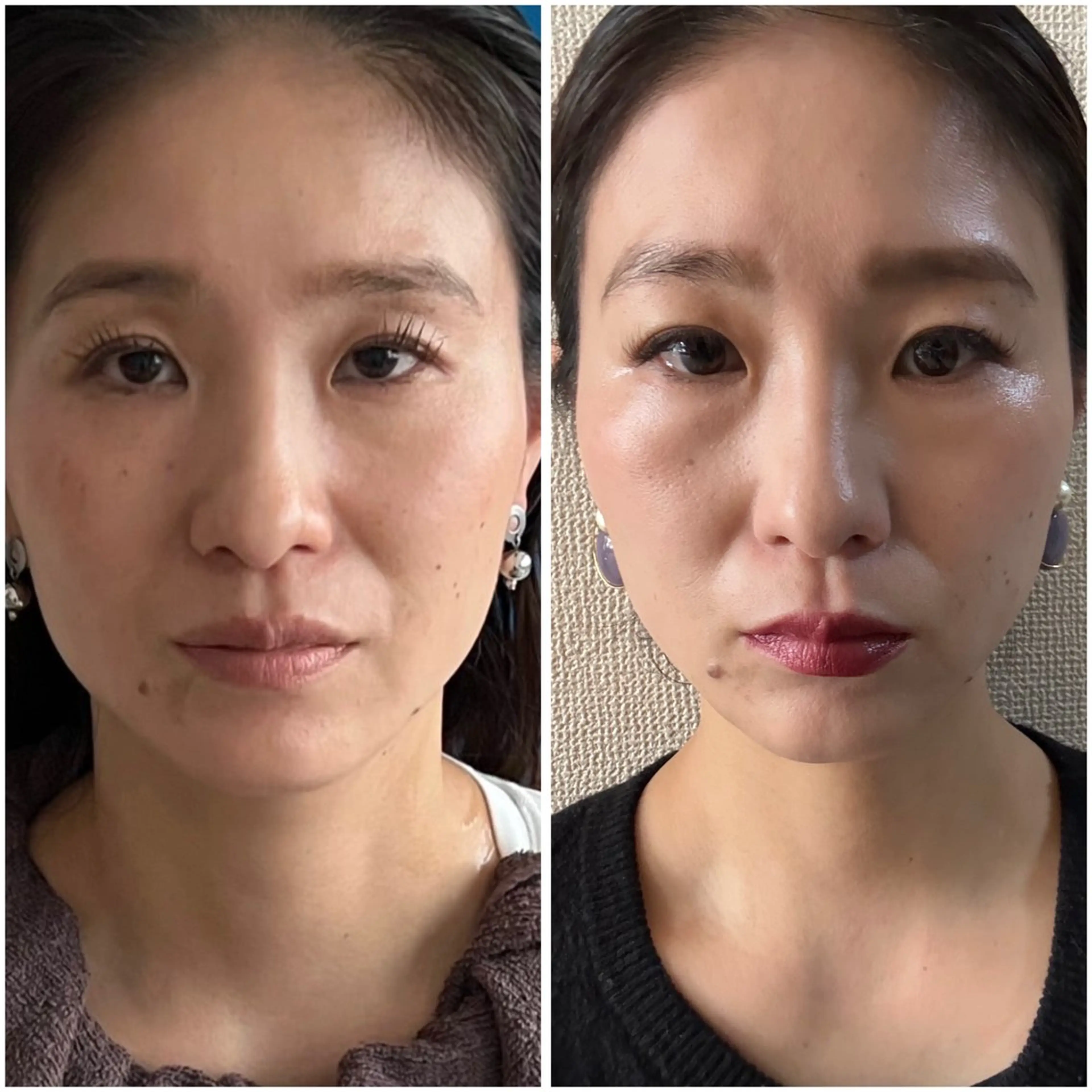 エステ リラク 【敏感肌管理×小顔サロン】Belle orchid所属・東三国/新大阪 敏感肌×小顔サロンのエステ・リラクイメージ