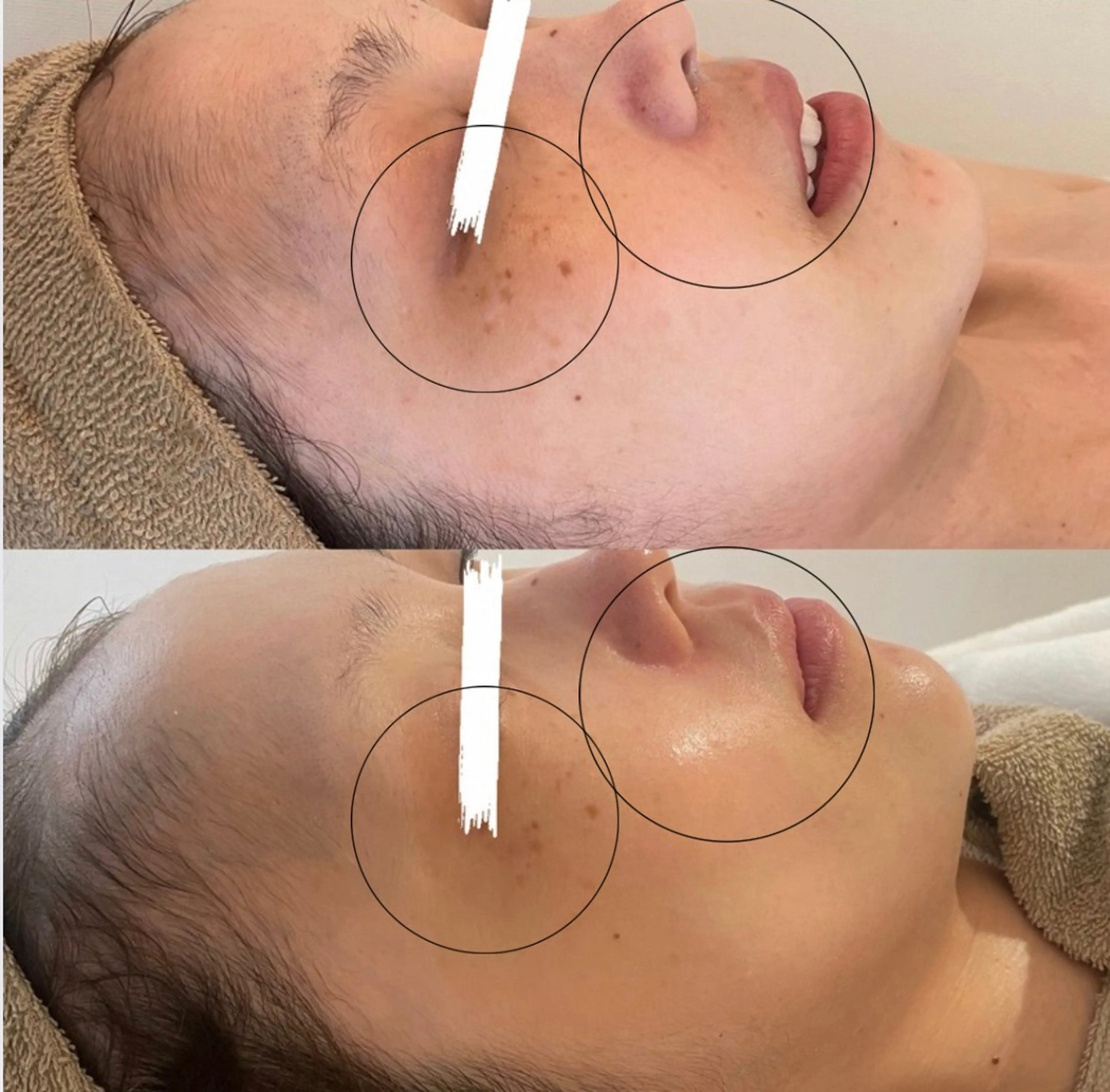 中目黒ハーブピーリン グ🌿ララピールのエステ・リラクイメージ