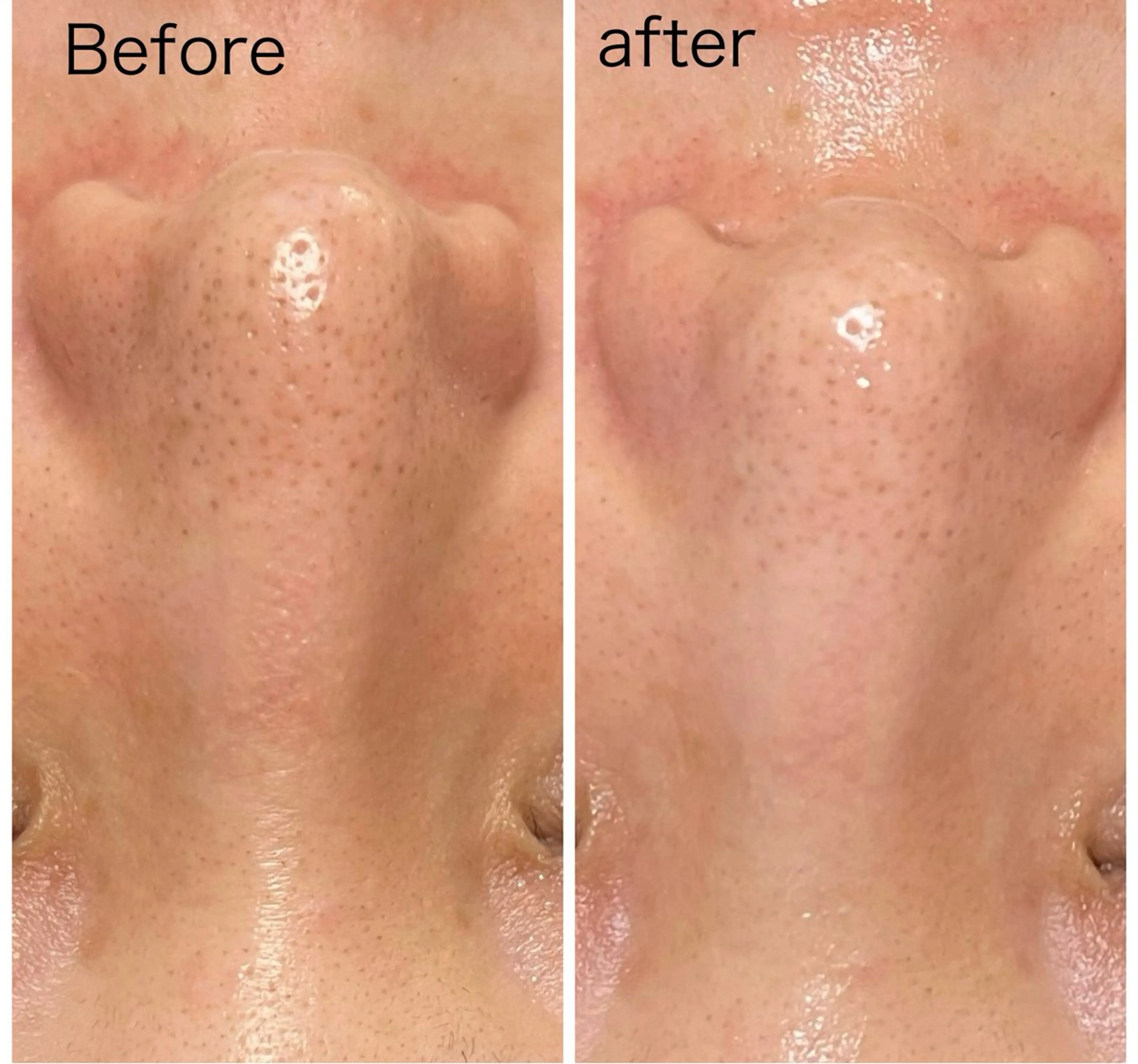 エイジングケア専門 Ponolaのエステ・リラクイメージ