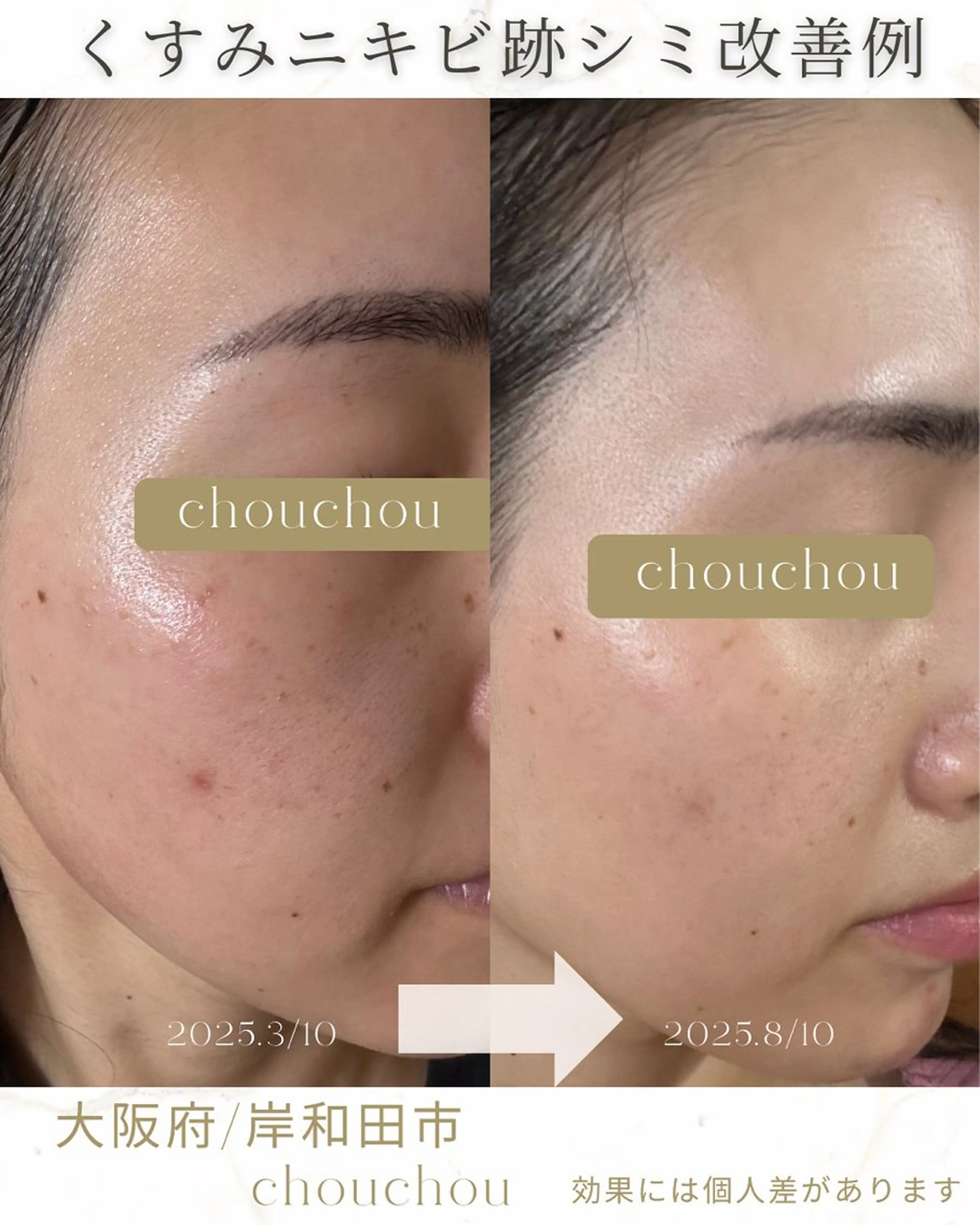 chouchou minaのエステ・リラクイメージ