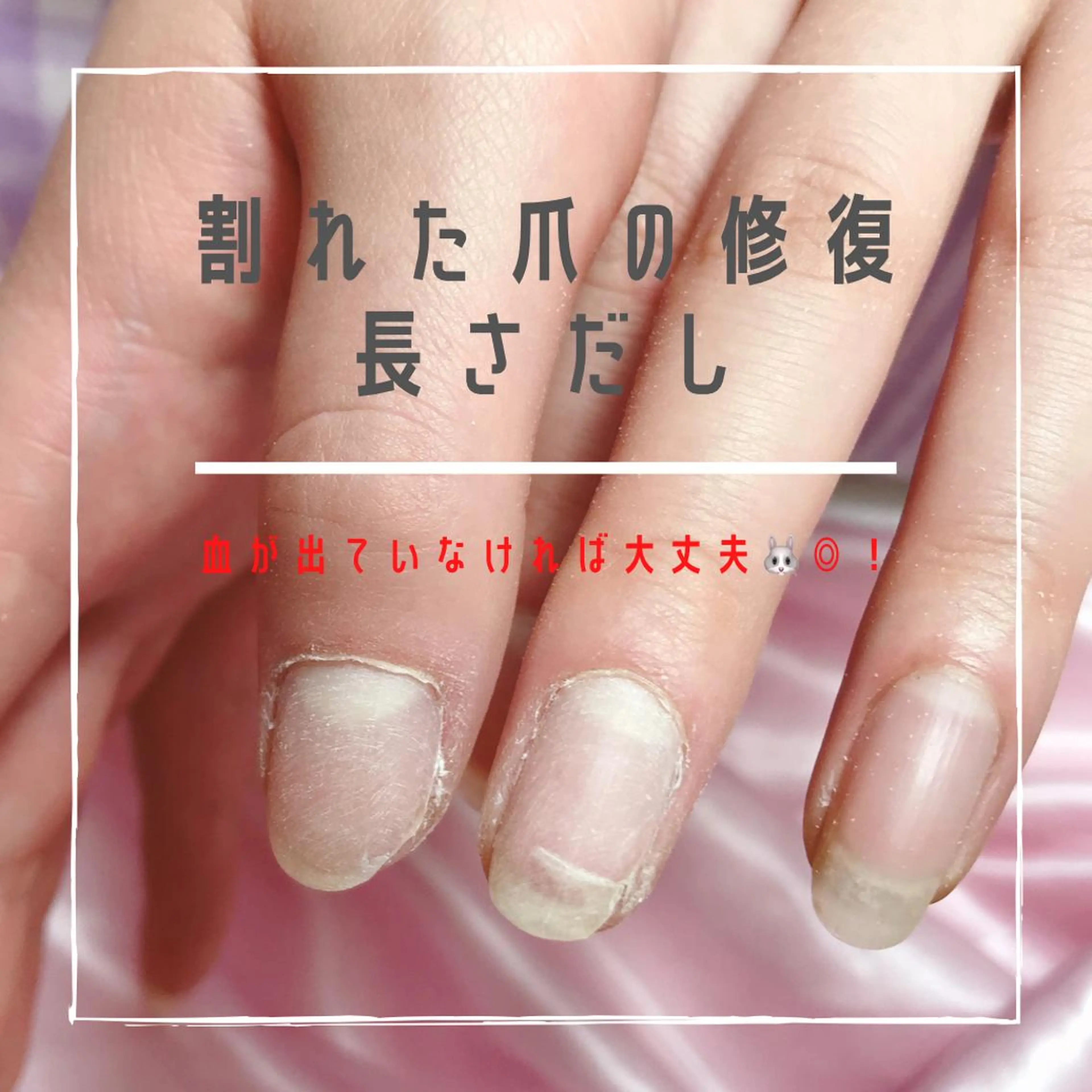 ネイル ハンドネイル 深爪を断らない スカルプ高評価店のネイルデザイン