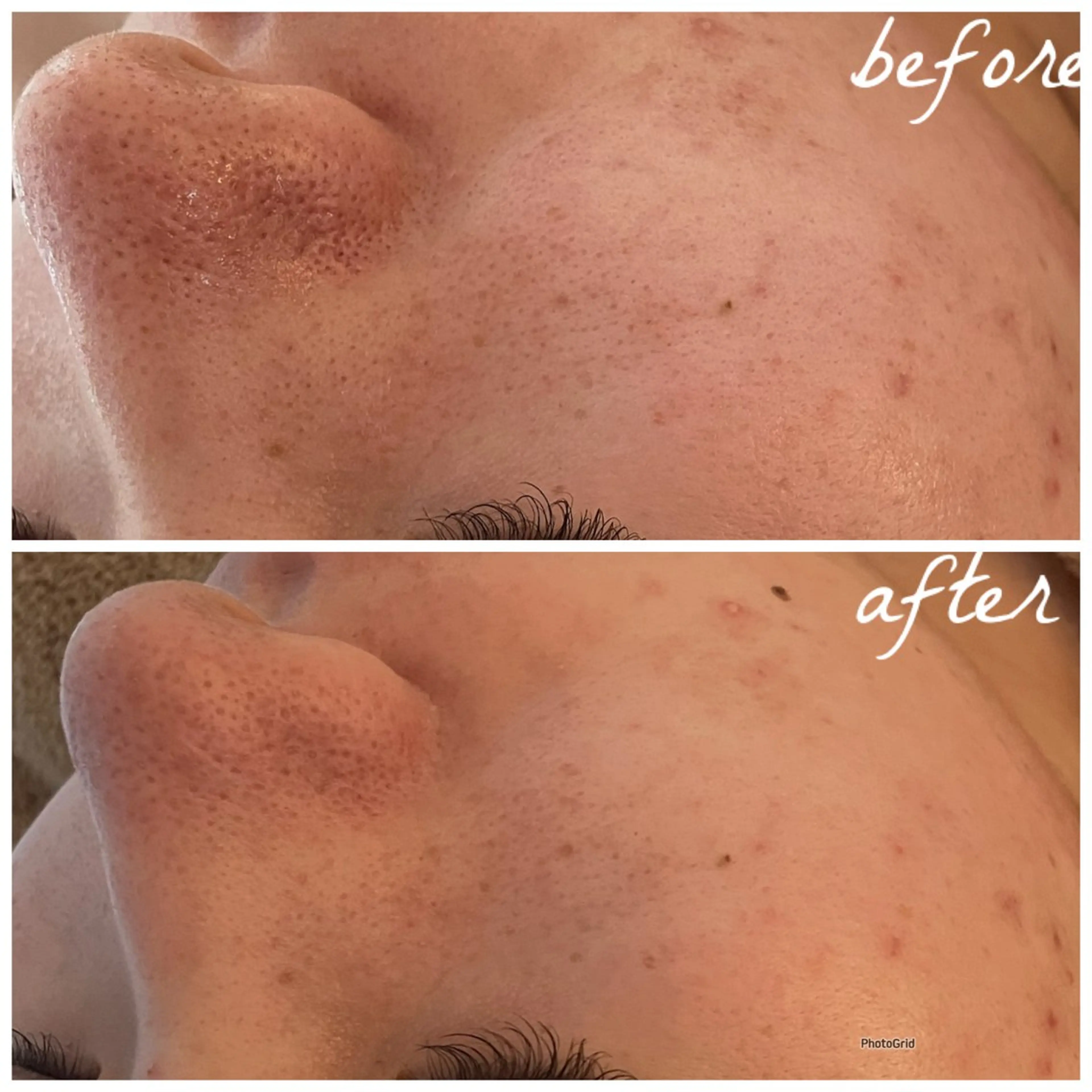 メンズ メナード岐阜茜部 杉浦のエステ・リラクイメージ