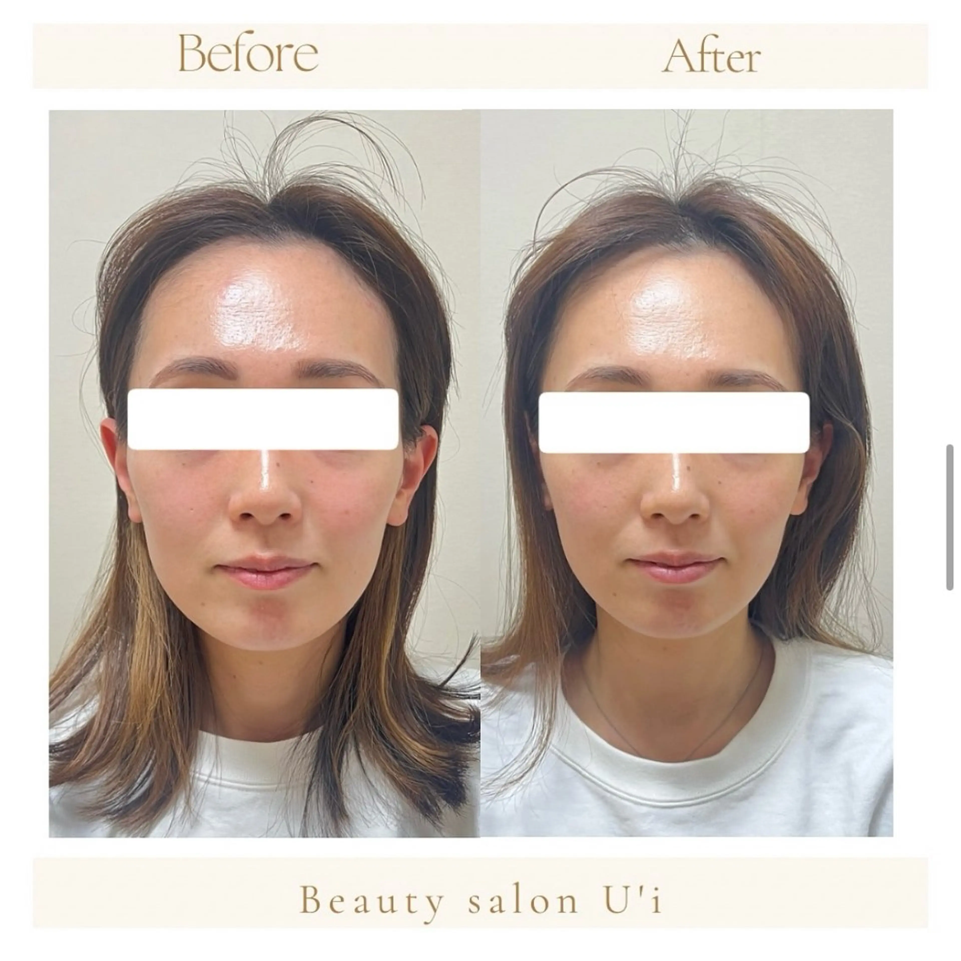 【初回】頭蓋骨小顔セラピアの写真