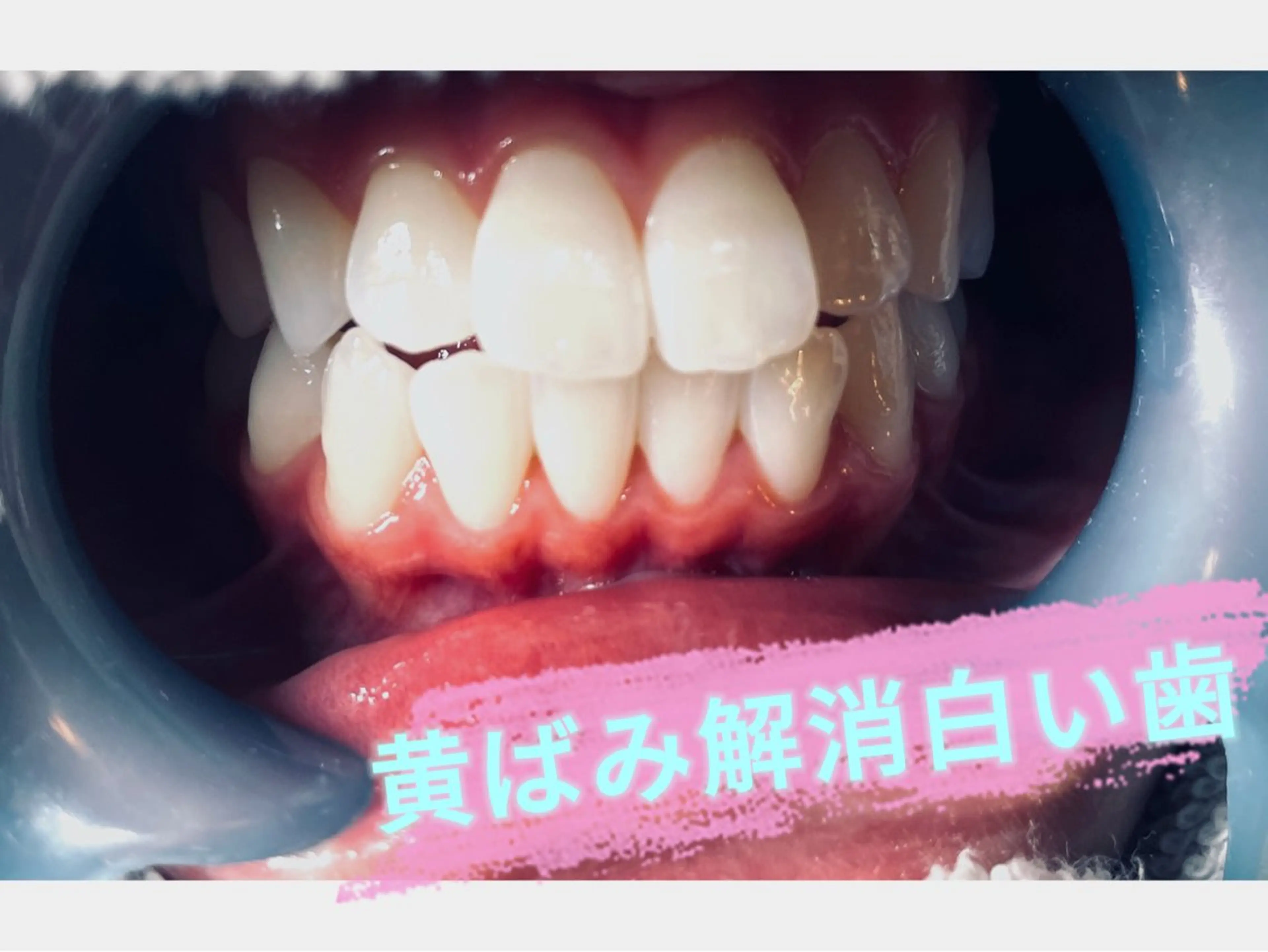 LOVELASH所属・恵比寿 LOVELASHのマツエク・マツパデザイン