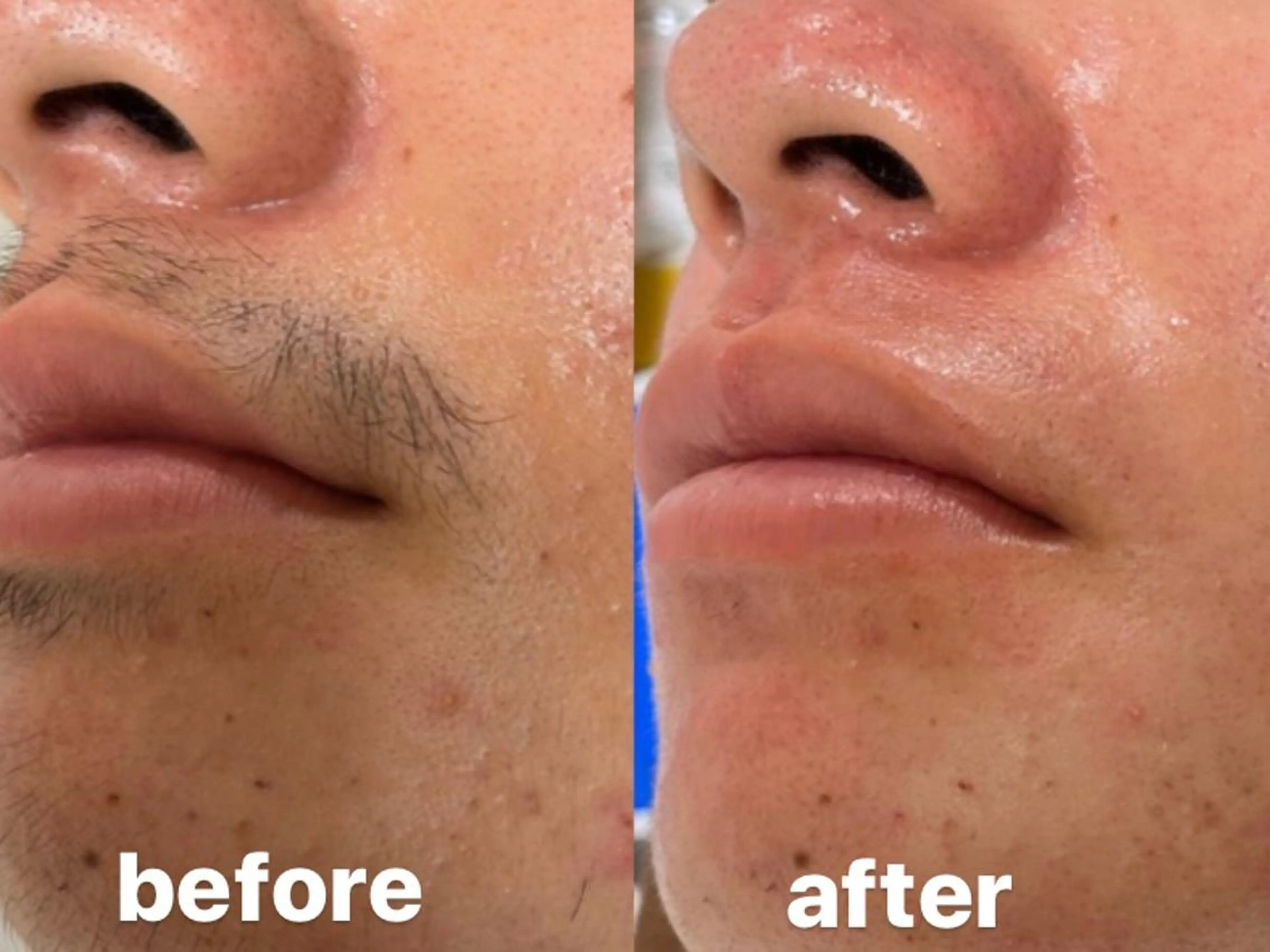 脱毛 emi ...の眉毛・アイブロウイメージ